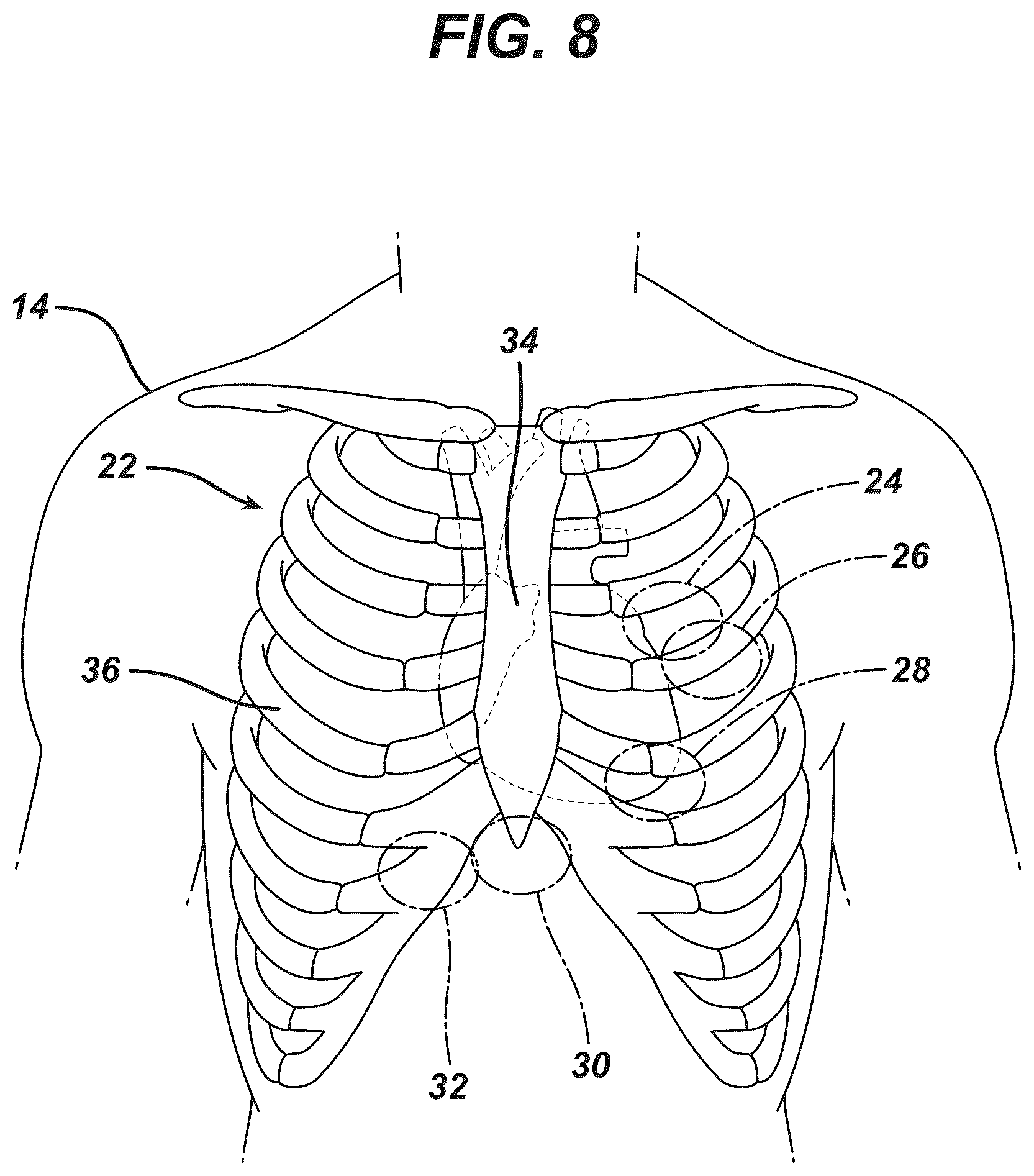 Patent US12097077 Figure 5 – Methods and systems for detecting heart conditions using medical imaging