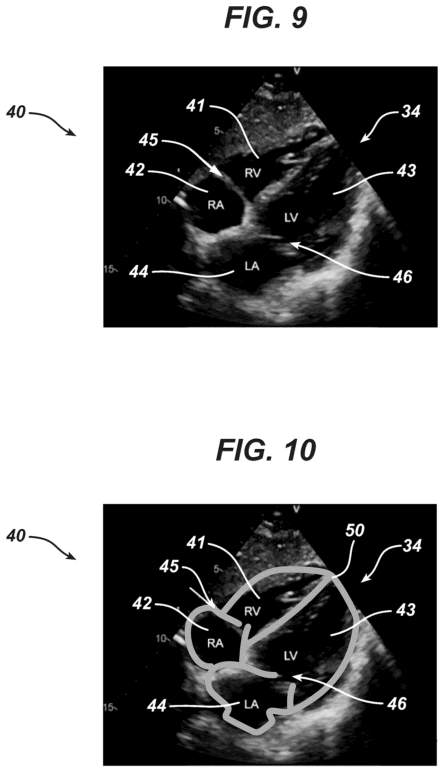 Patent US12097077 Figure 6 – Methods and systems for detecting heart conditions using medical imaging