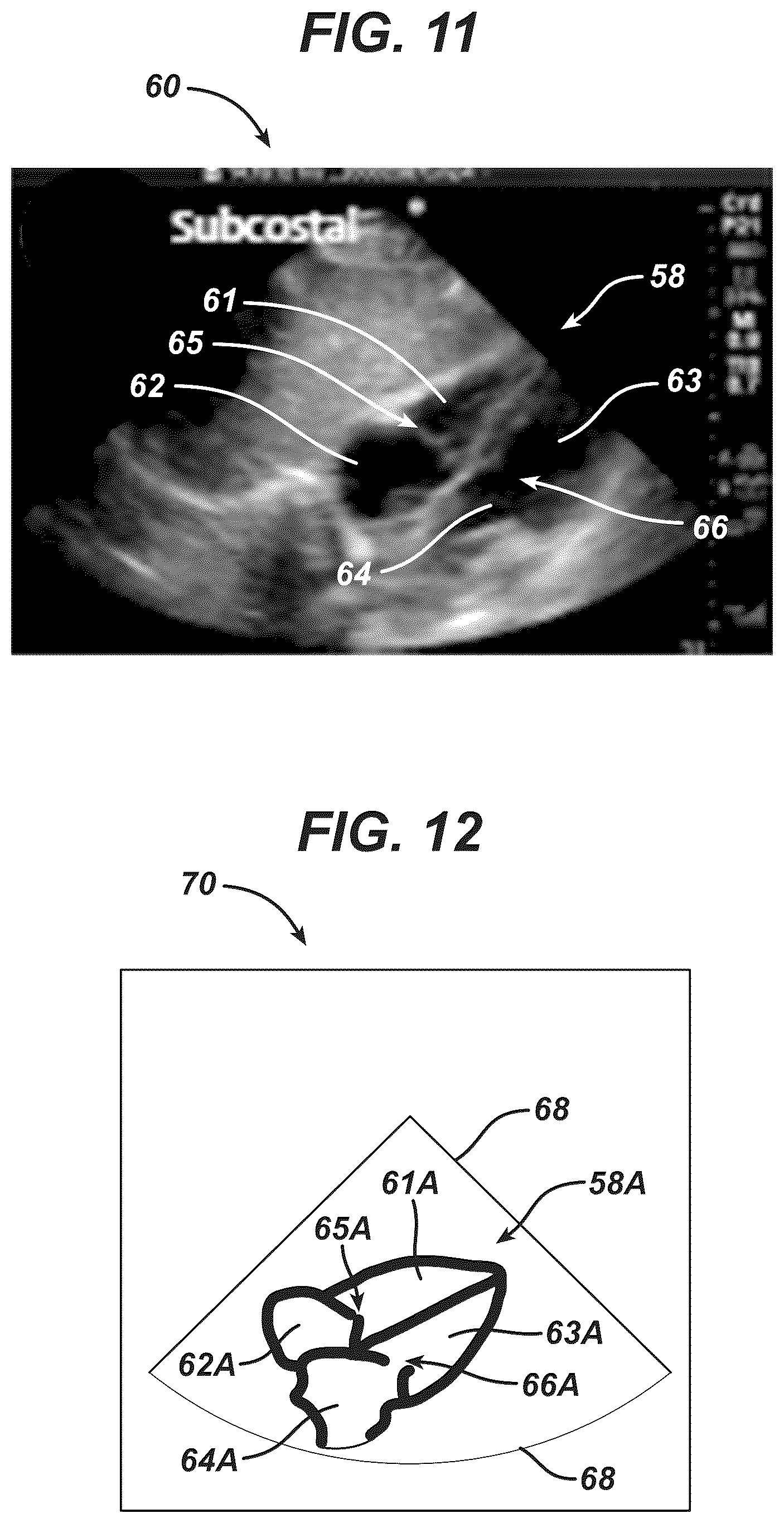 Patent US12097077 Figure 7 – Methods and systems for detecting heart conditions using medical imaging