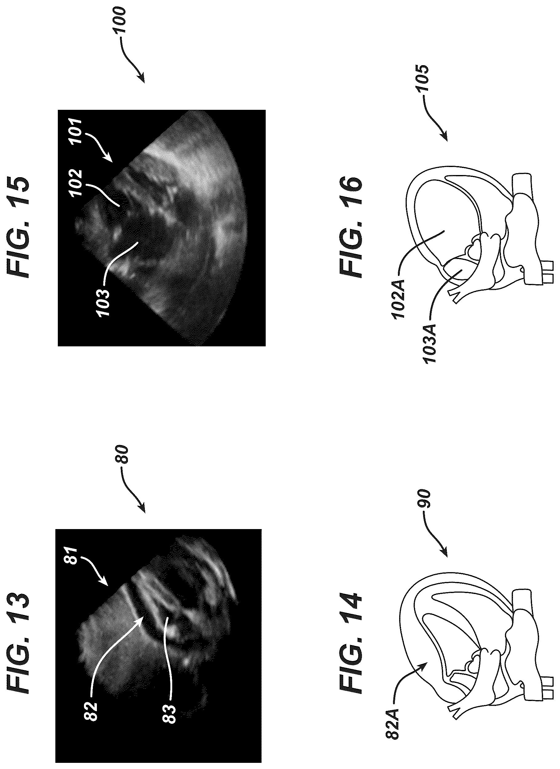 Patent US12097077 Figure 8 – Methods and systems for detecting heart conditions using medical imaging
