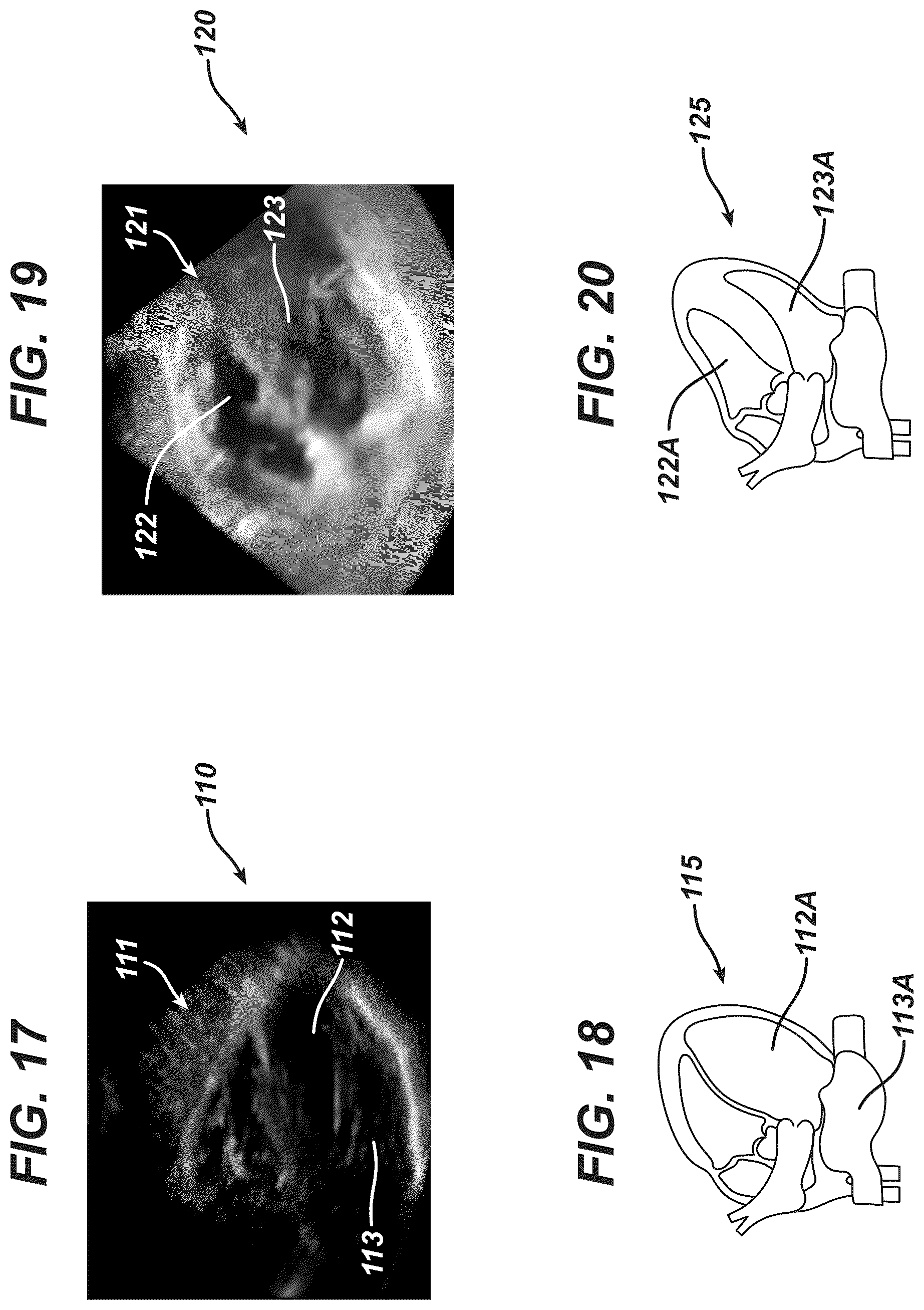 Patent US12097077 Figure 9 – Methods and systems for detecting heart conditions using medical imaging