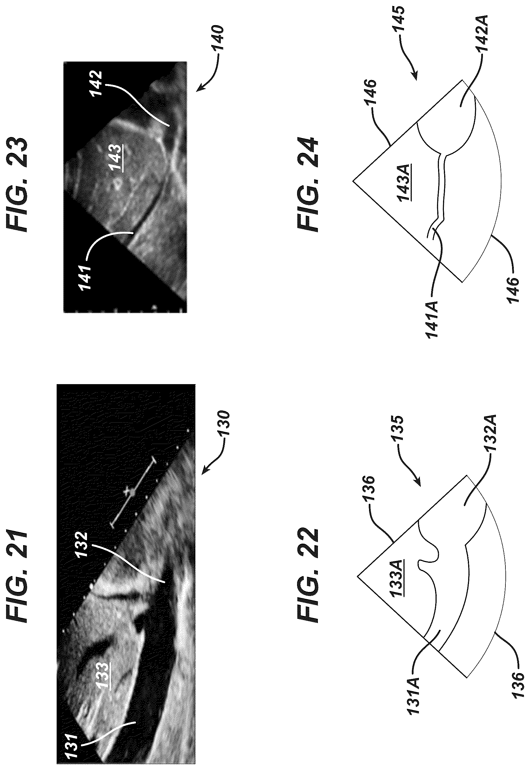 Patent US12097077 Figure 10 – Methods and systems for detecting heart conditions using medical imaging