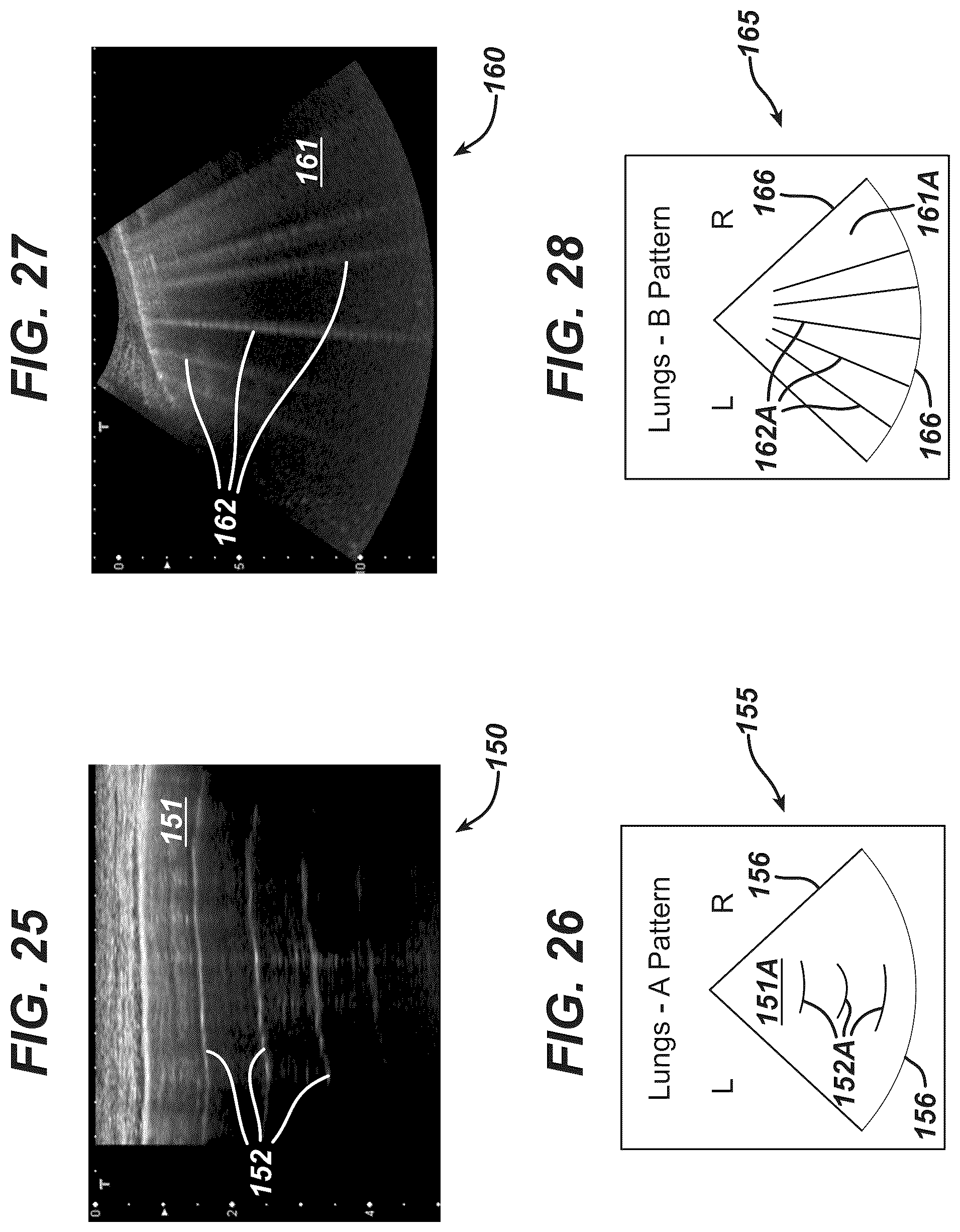 Patent US12097077 Figure 11 – Methods and systems for detecting heart conditions using medical imaging