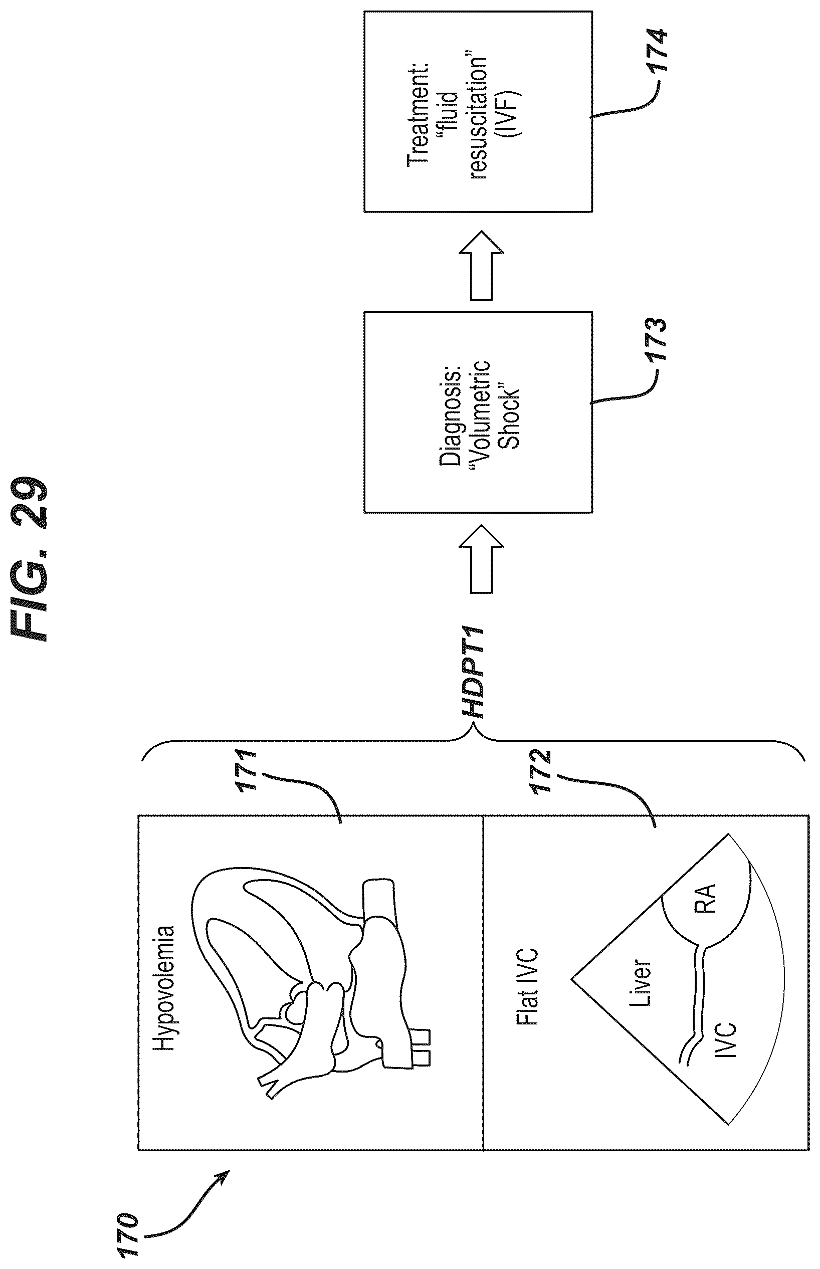 Patent US12097077 Figure 12 – Methods and systems for detecting heart conditions using medical imaging