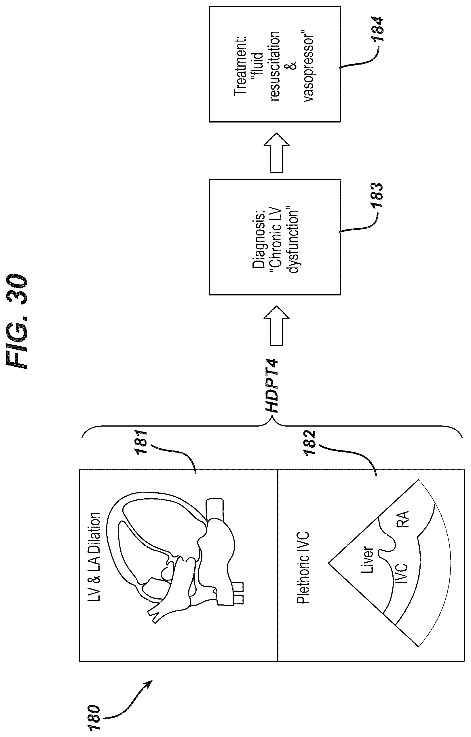 Patent US12097077 Figure 13 – Methods and systems for detecting heart conditions using medical imaging