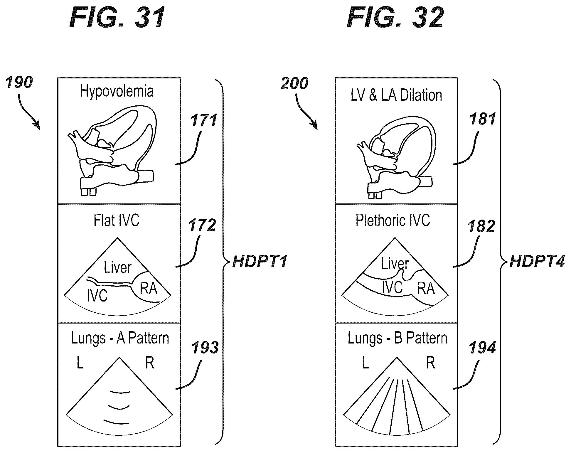 Patent US12097077 Figure 14 – Methods and systems for detecting heart conditions using medical imaging