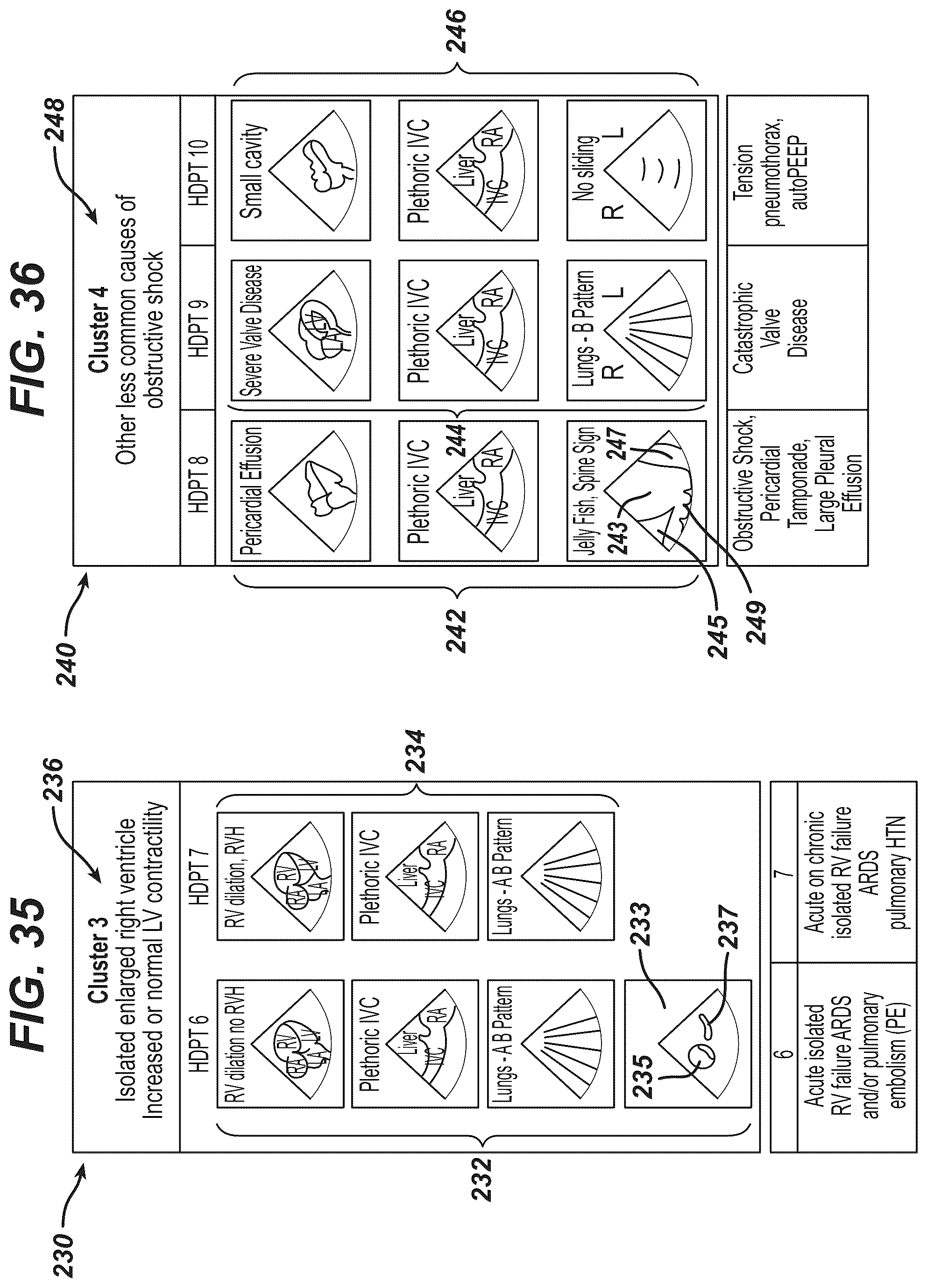 Patent US12097077 Figure 16 – Methods and systems for detecting heart conditions using medical imaging