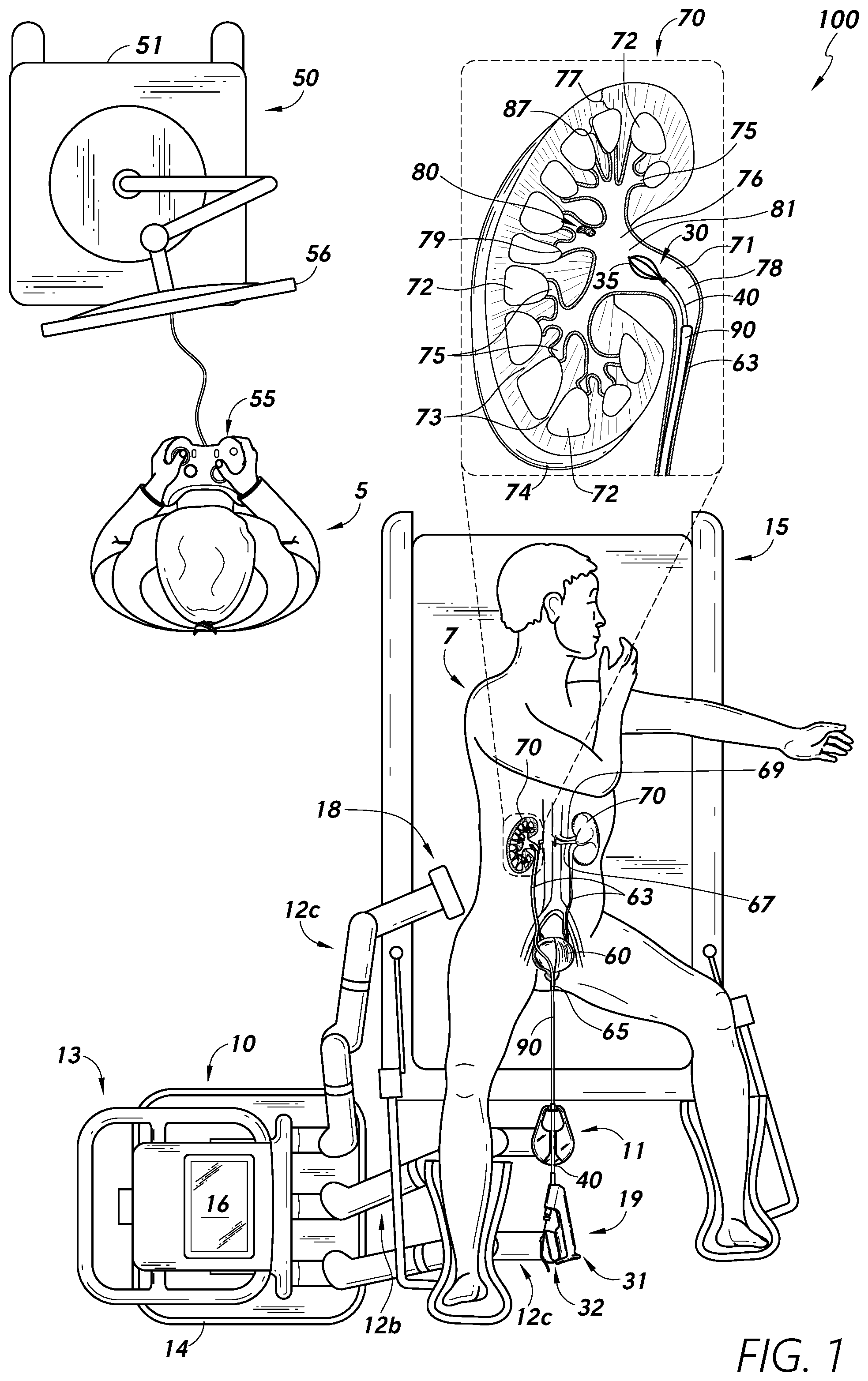 Patent US12097079 — Stuck instrument management — Figure 1