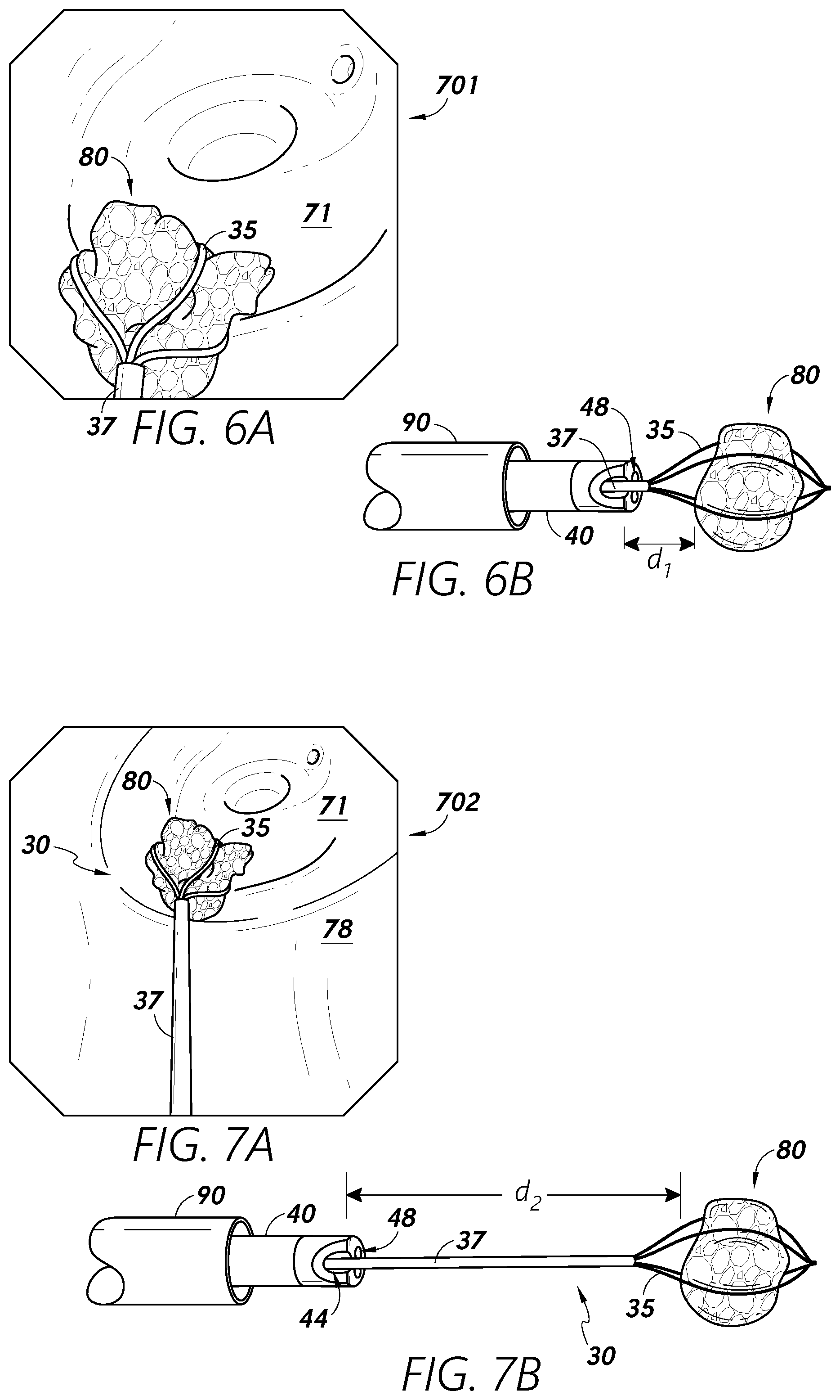 Patent US12097079 Figure 8 – Stuck instrument management