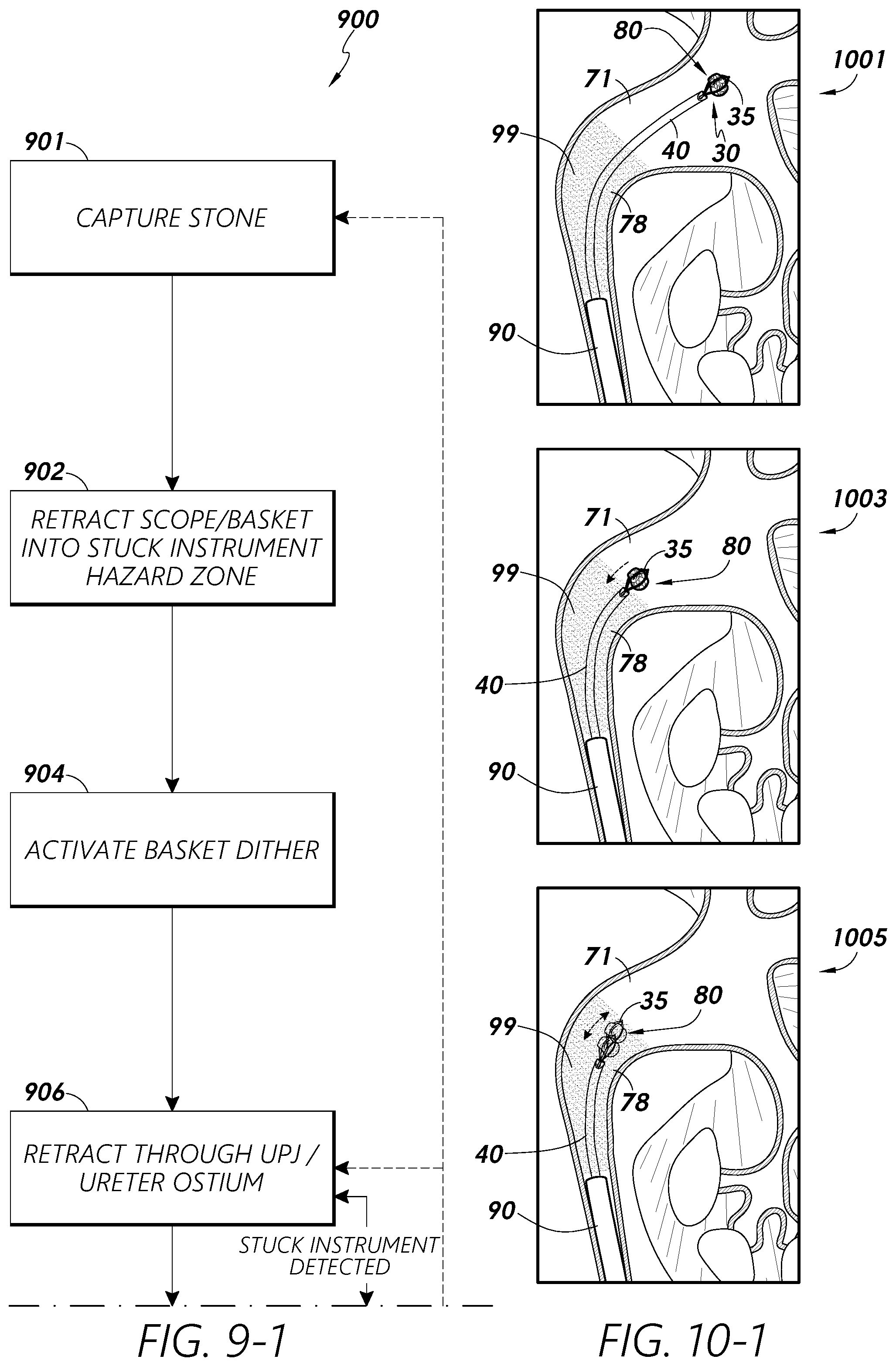 Patent US12097079 Figure 10 – Stuck instrument management