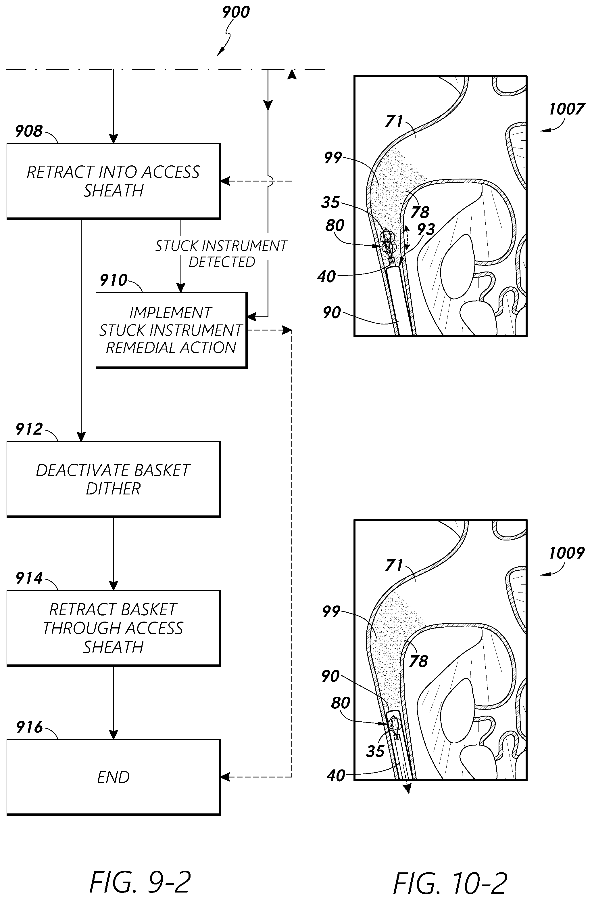 Patent US12097079 Figure 11 – Stuck instrument management