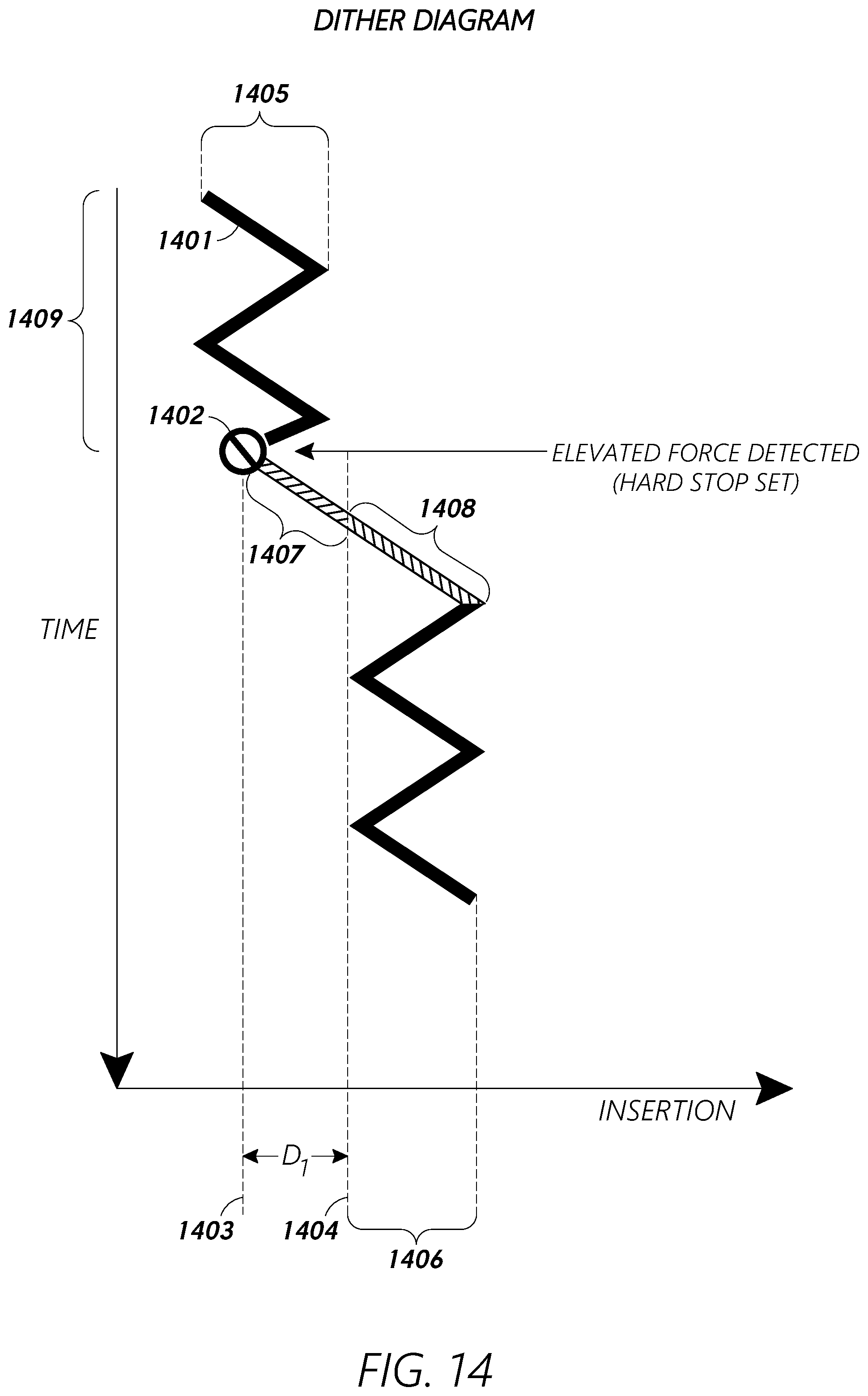 Patent US12097079 Figure 15 – Stuck instrument management