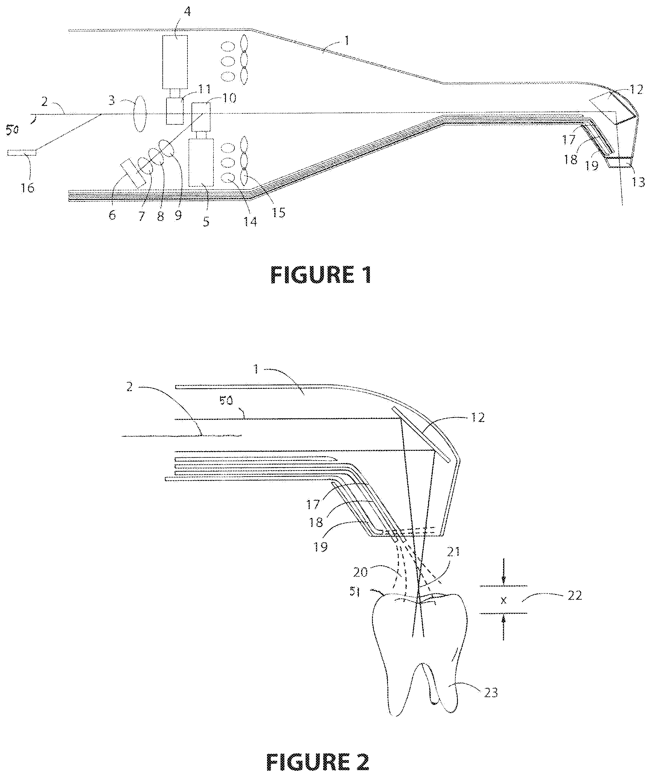 Patent US12097081 — Laser based computer controlled dental preparation system — Figure 1