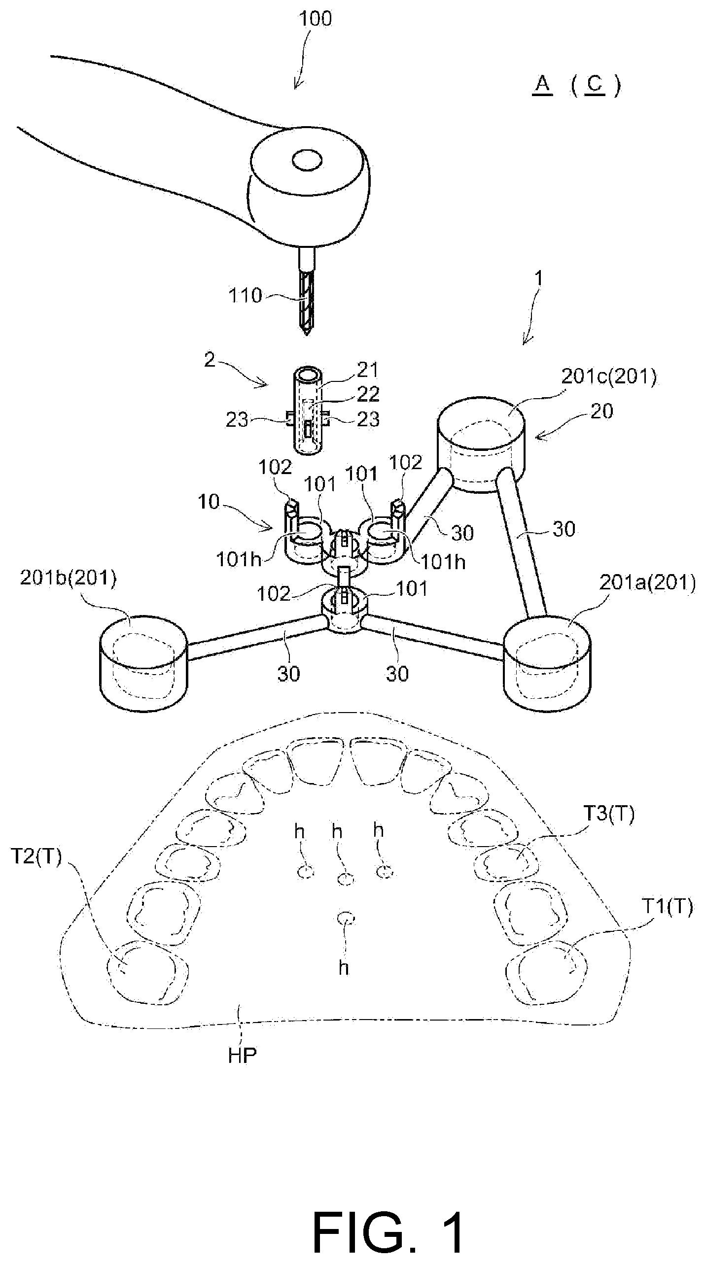 Patent US12097082 Figure 1 – Drill assistance device, screw guide device, and orthodontic tool installation-assisting device set