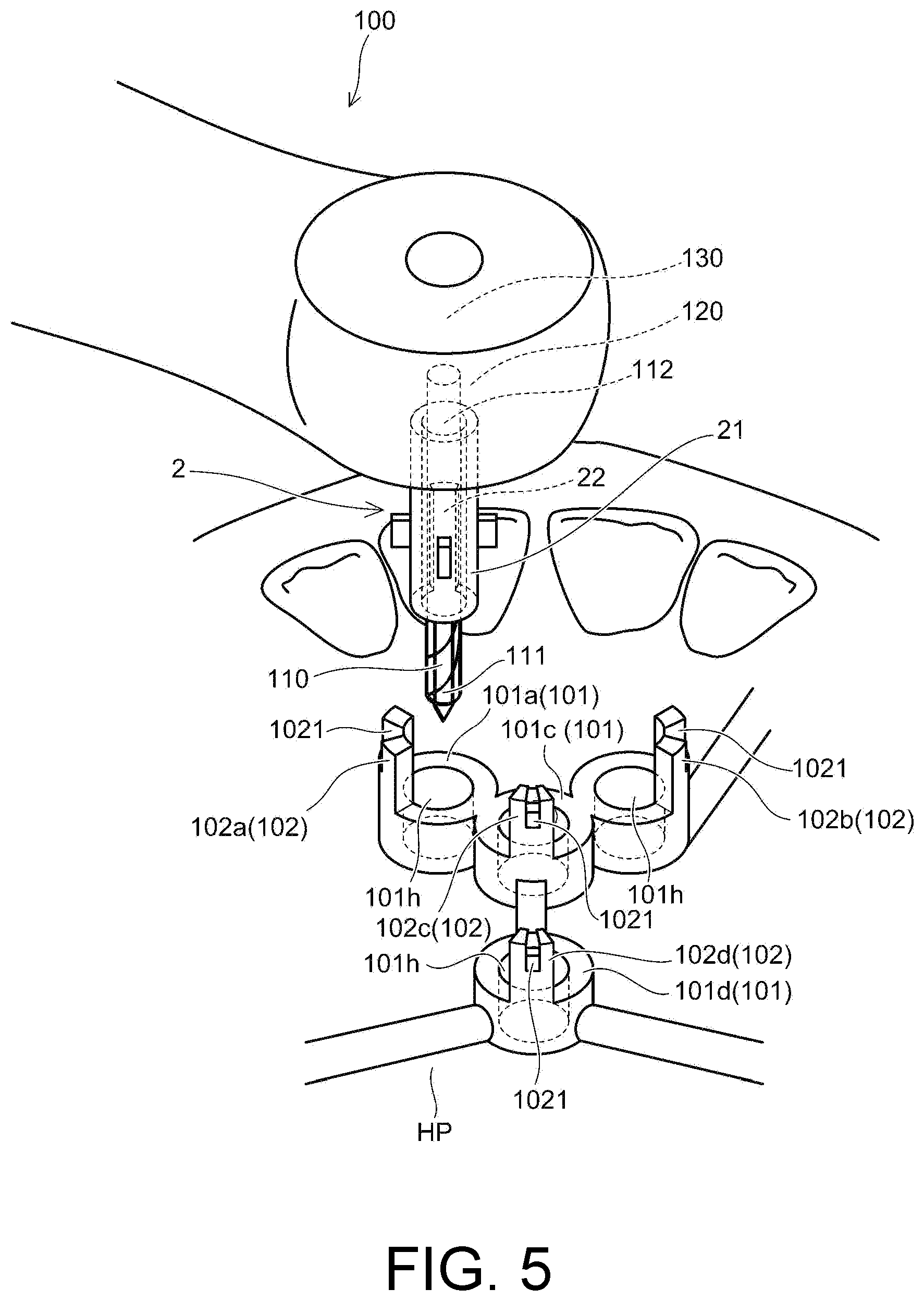 Patent US12097082 Figure 5 – Drill assistance device, screw guide device, and orthodontic tool installation-assisting device set