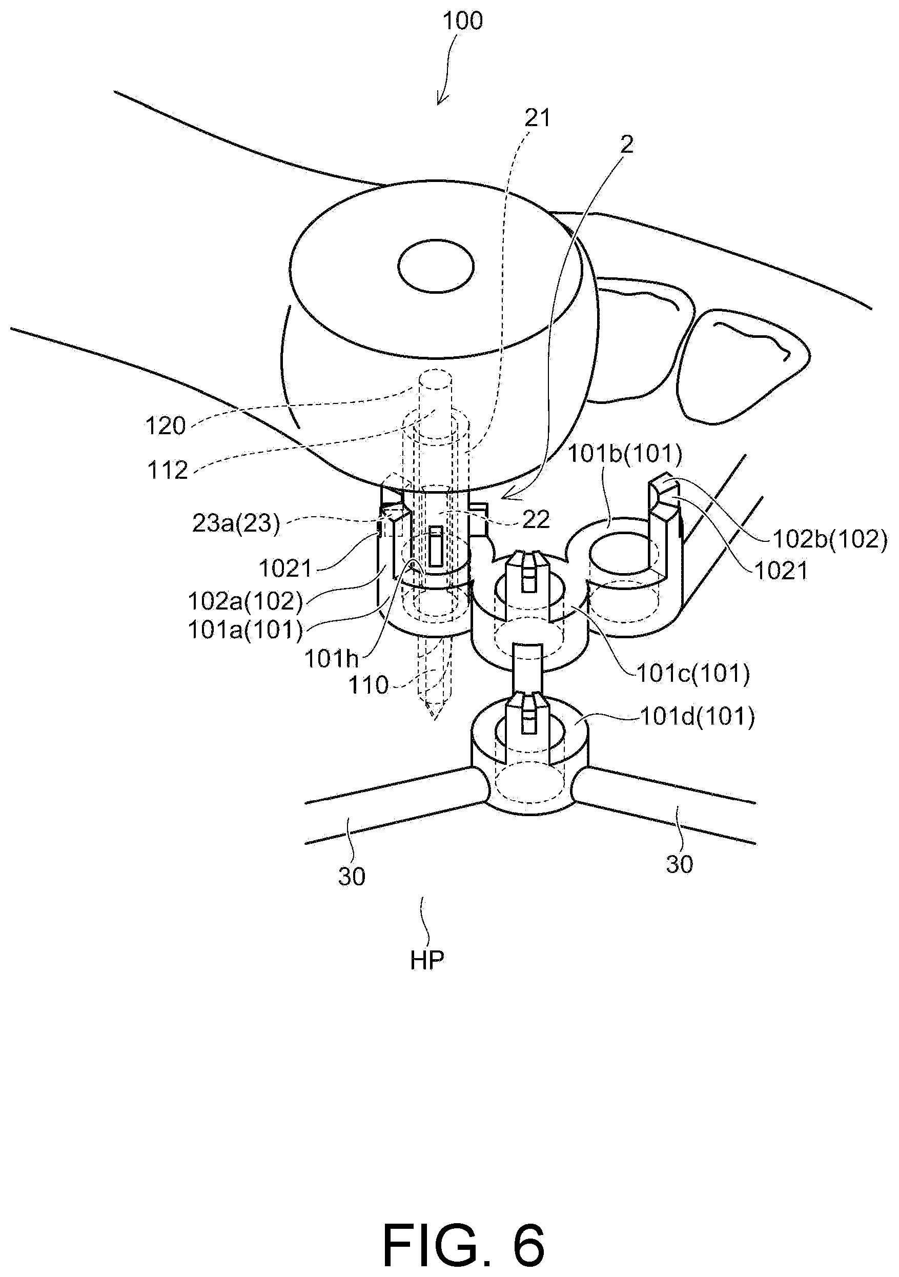 Patent US12097082 Figure 6 – Drill assistance device, screw guide device, and orthodontic tool installation-assisting device set