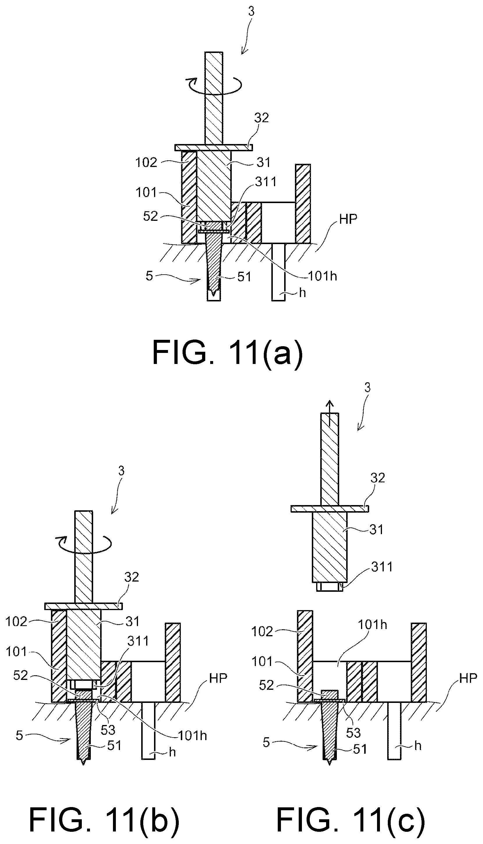 Patent US12097082 Figure 11 – Drill assistance device, screw guide device, and orthodontic tool installation-assisting device set