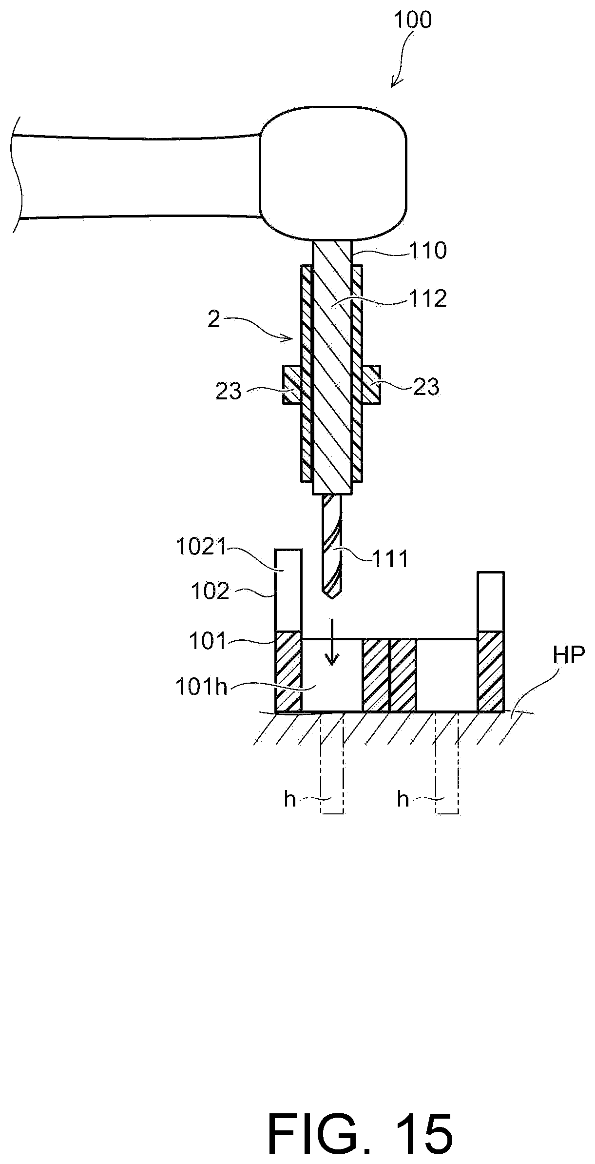Patent US12097082 Figure 15 – Drill assistance device, screw guide device, and orthodontic tool installation-assisting device set
