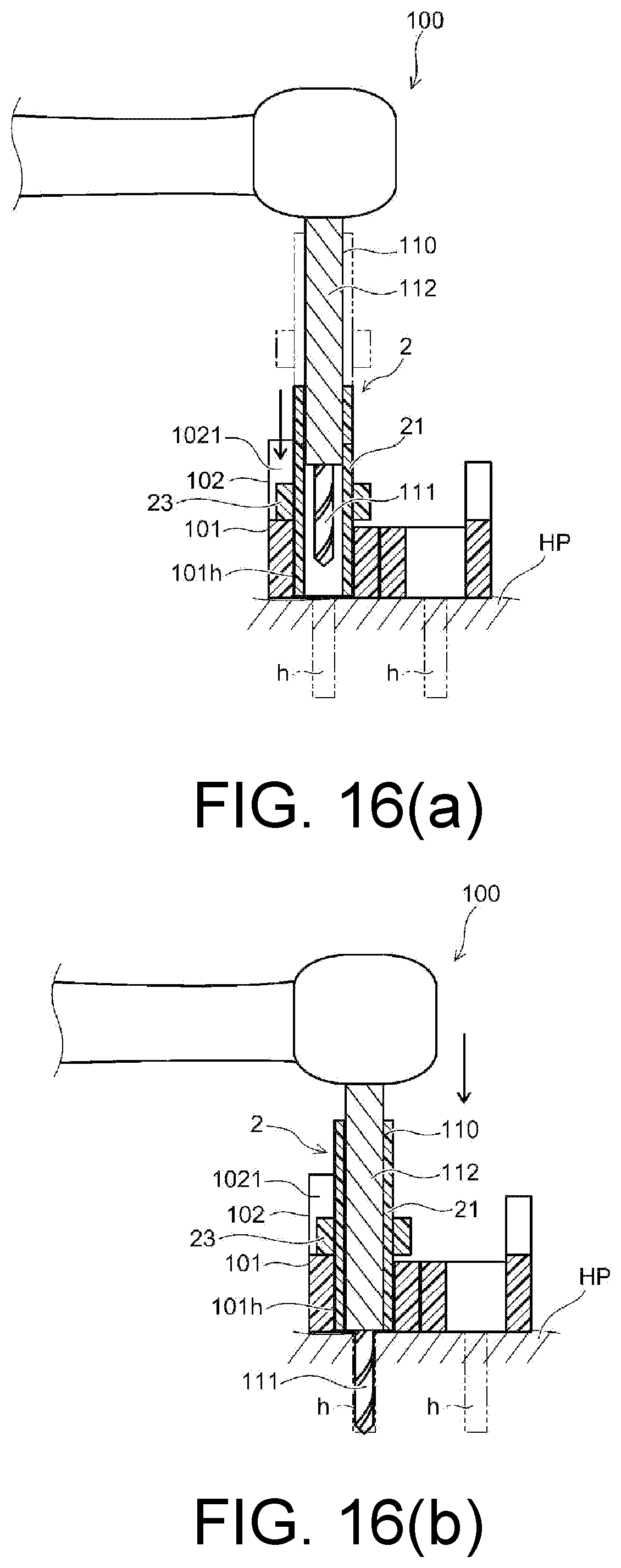 Patent US12097082 Figure 16 – Drill assistance device, screw guide device, and orthodontic tool installation-assisting device set