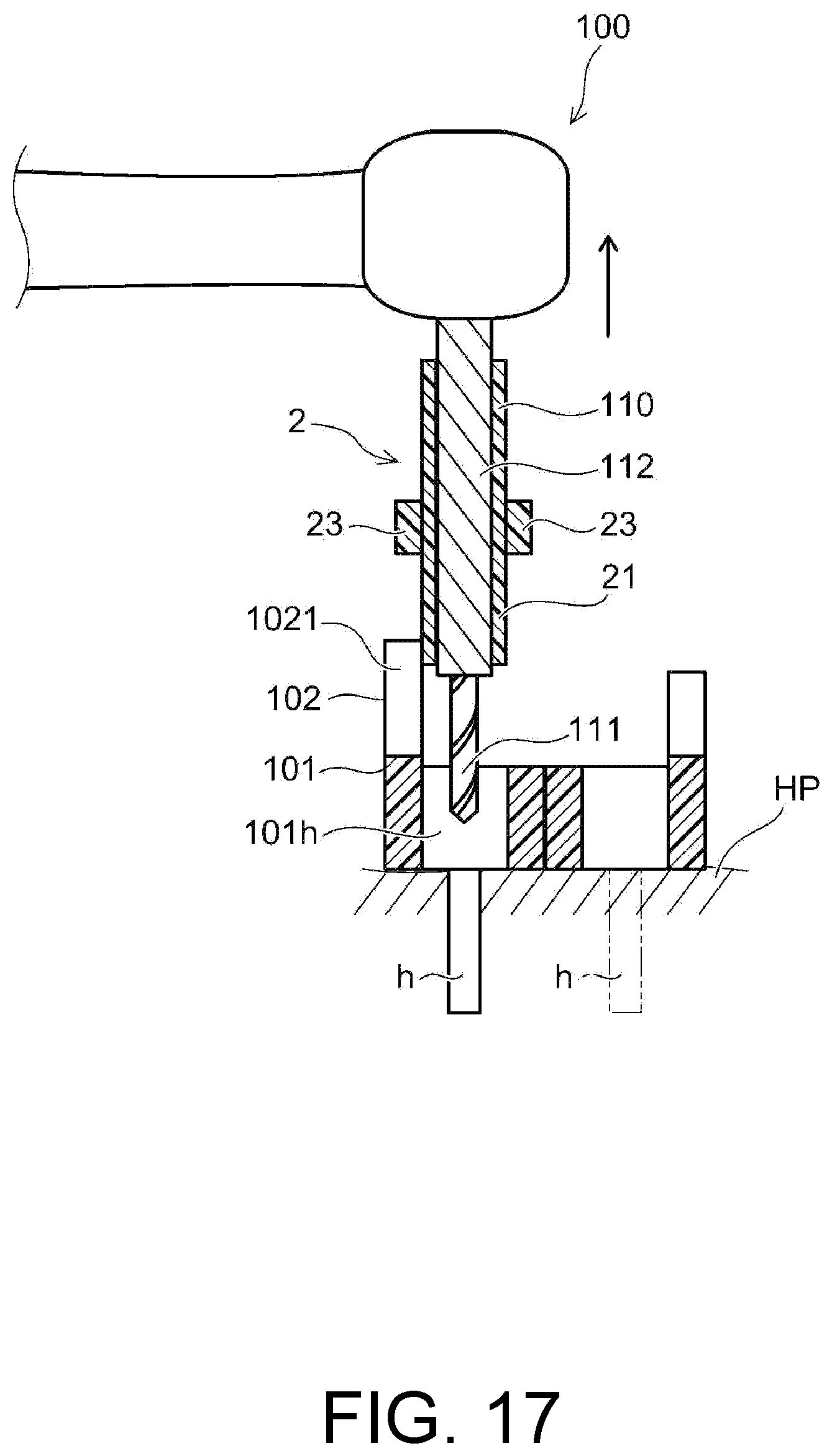 Patent US12097082 Figure 17 – Drill assistance device, screw guide device, and orthodontic tool installation-assisting device set