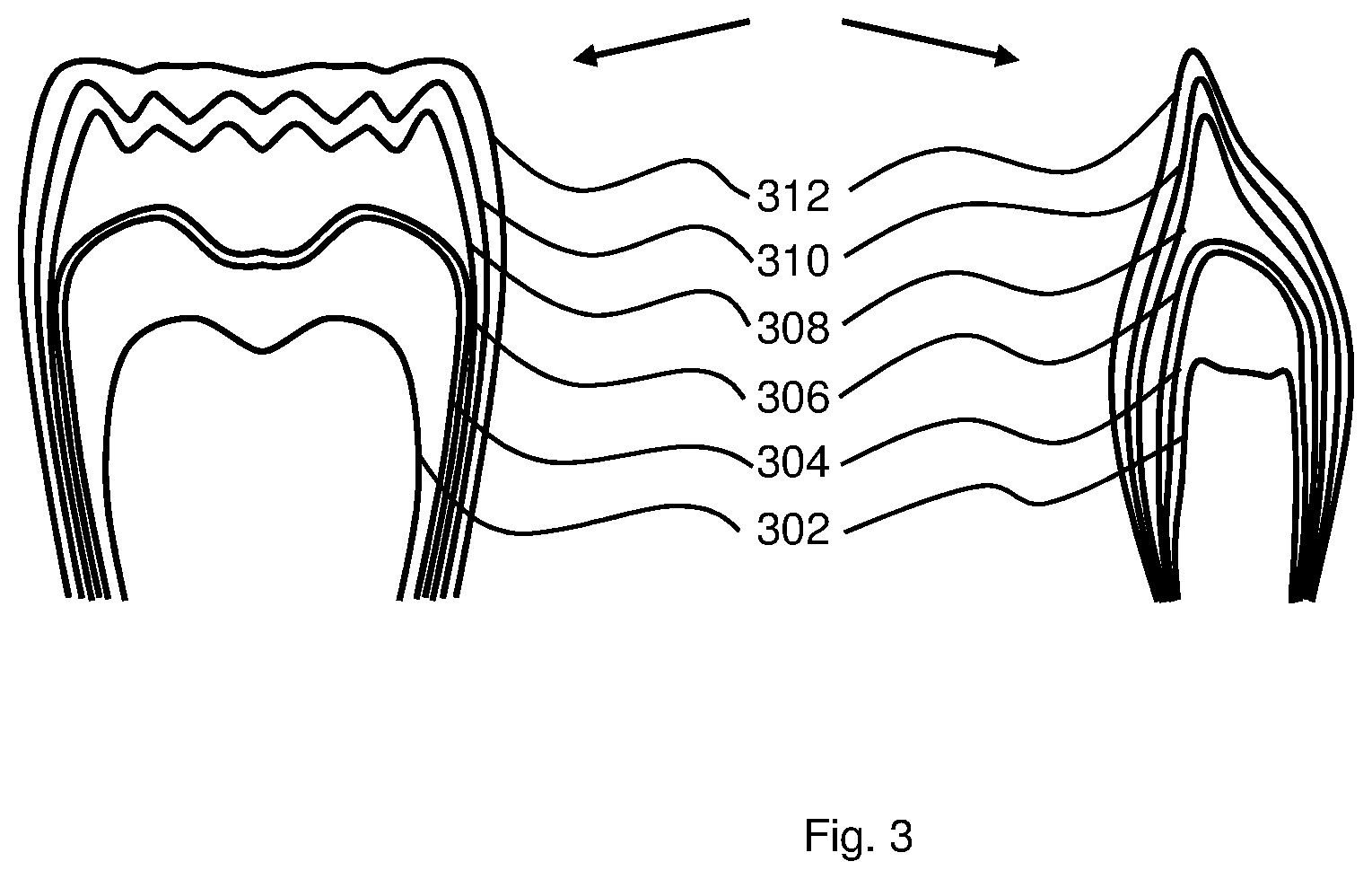 Patent US12097083 Figure 3 – Method and device for providing ingredient data for a prosthesis