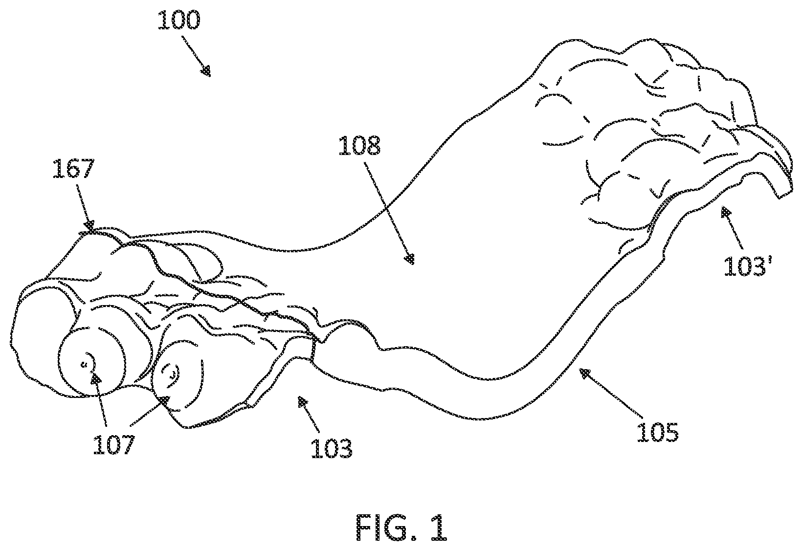 Patent US12097085 Figure 1 – Palatal expanders with breach regions