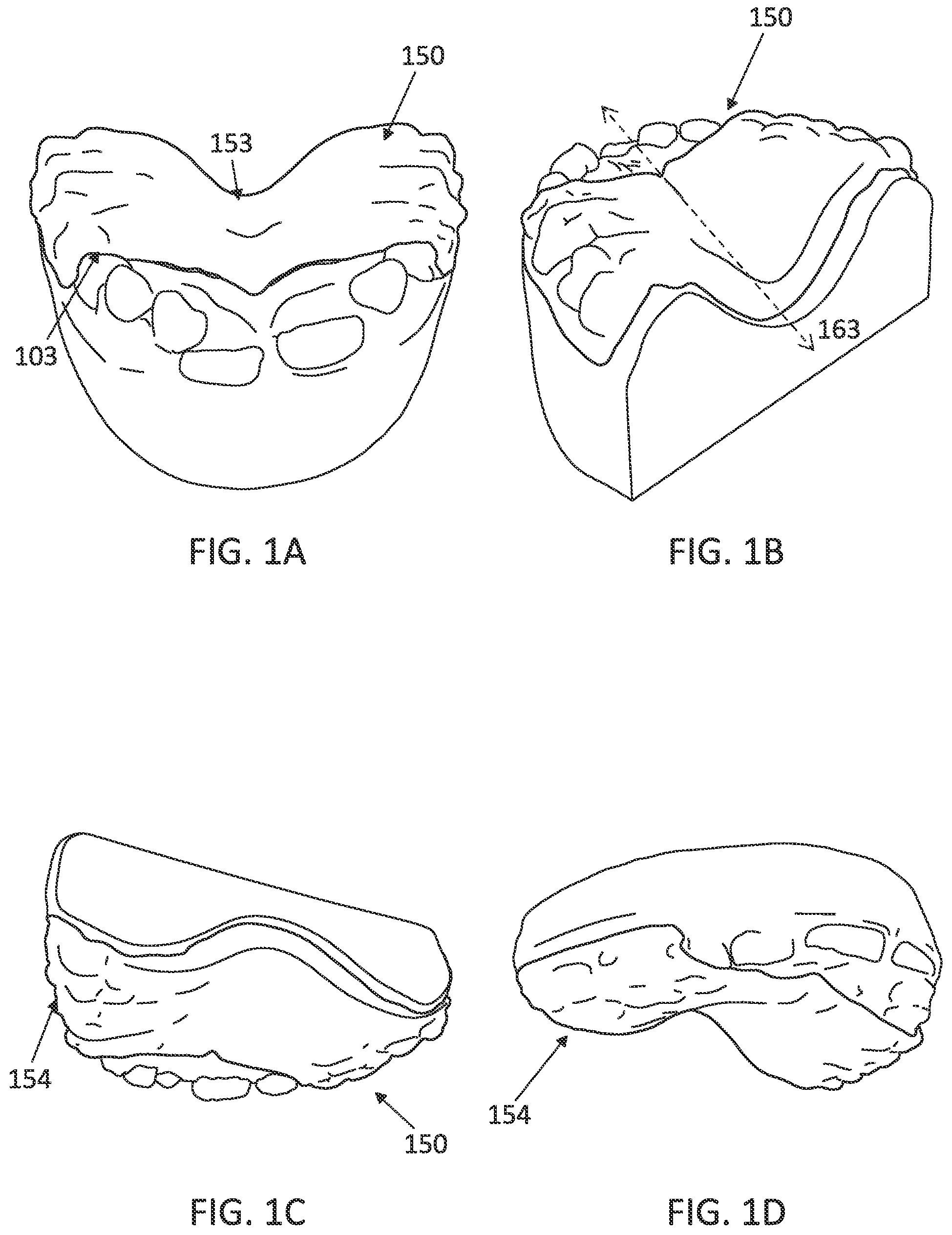 Patent US12097085 Figure 2 – Palatal expanders with breach regions