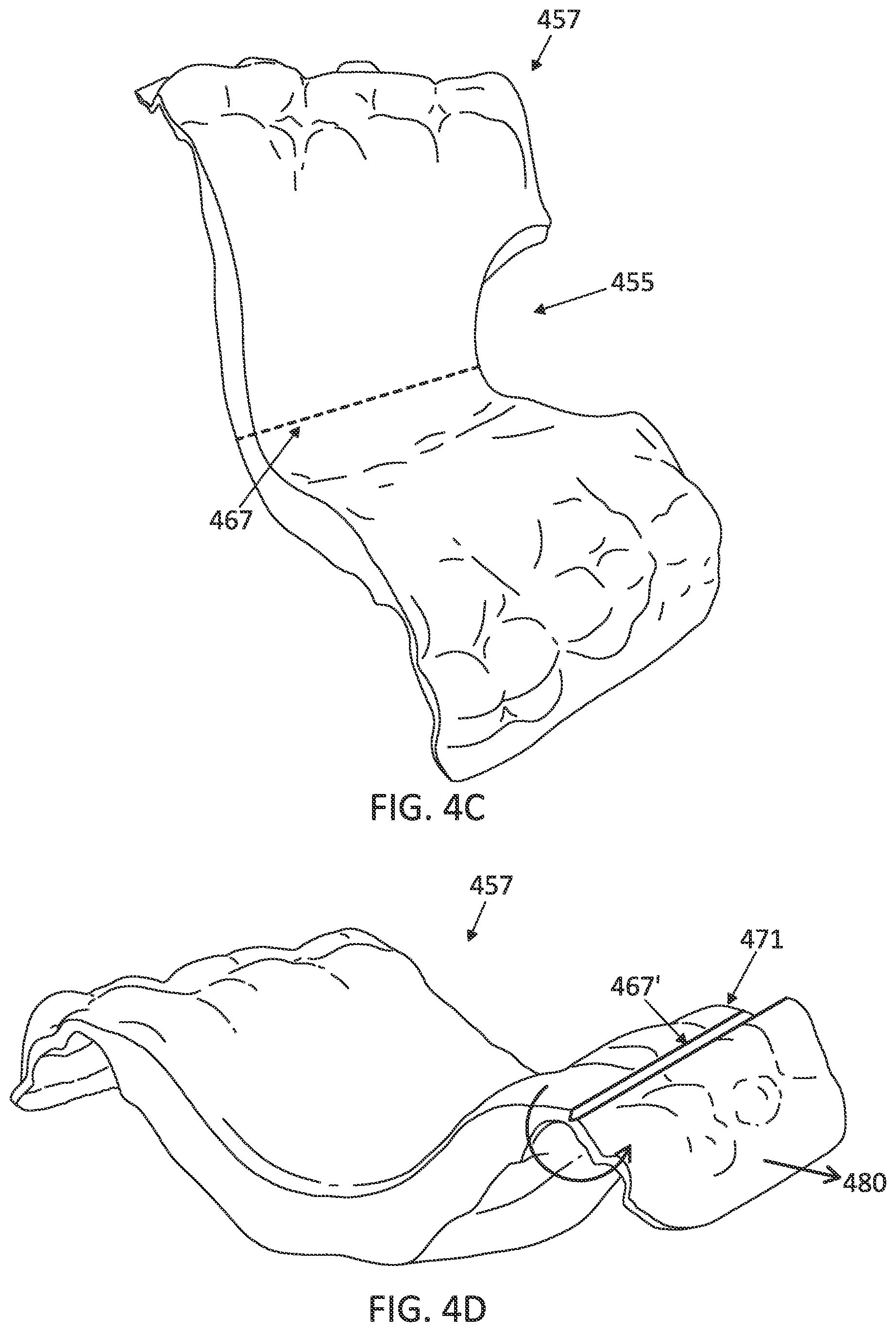 Patent US12097085 Figure 8 – Palatal expanders with breach regions