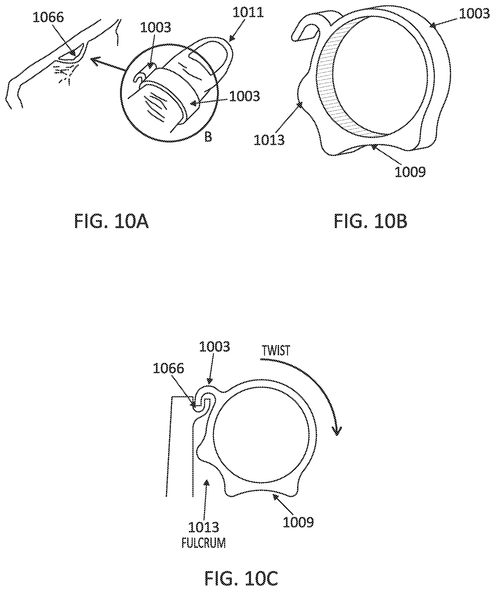 Patent US12097085 Figure 15 – Palatal expanders with breach regions
