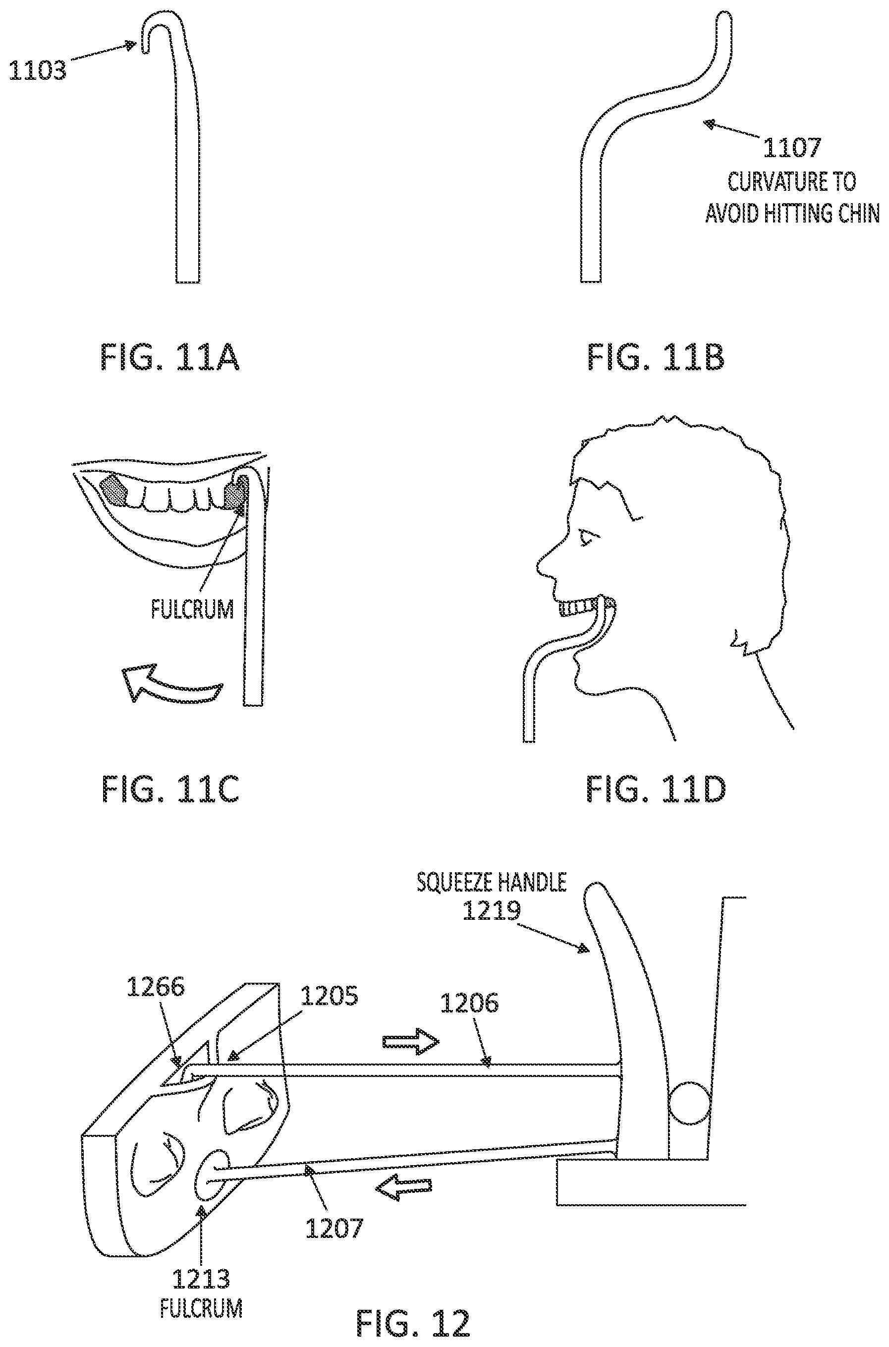 Patent US12097085 Figure 16 – Palatal expanders with breach regions