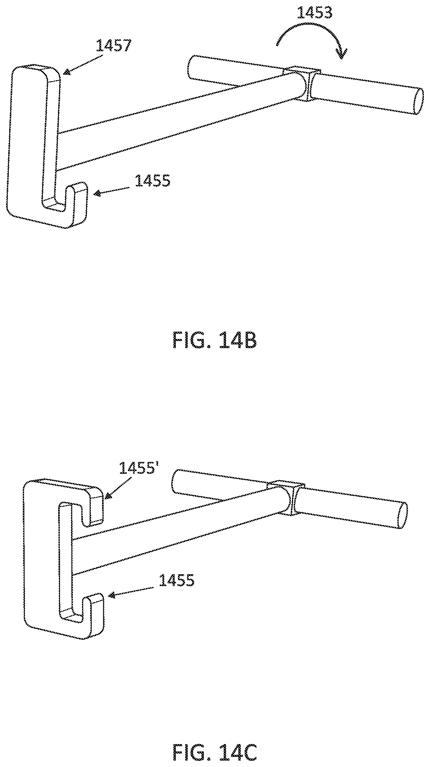 Patent US12097085 Figure 18 – Palatal expanders with breach regions