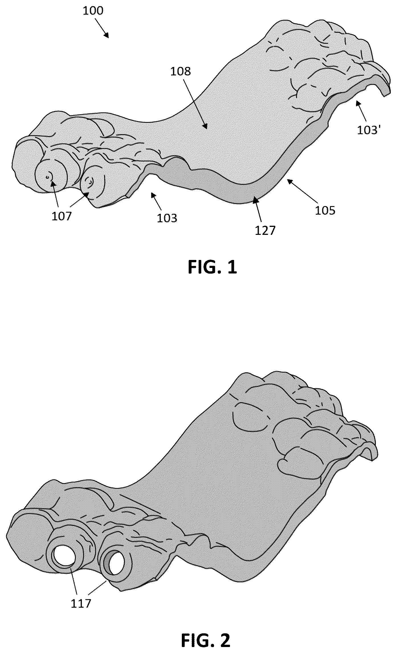 Patent US12097086 Figure 1 – Palatal expanders and methods of designing palatal expanders