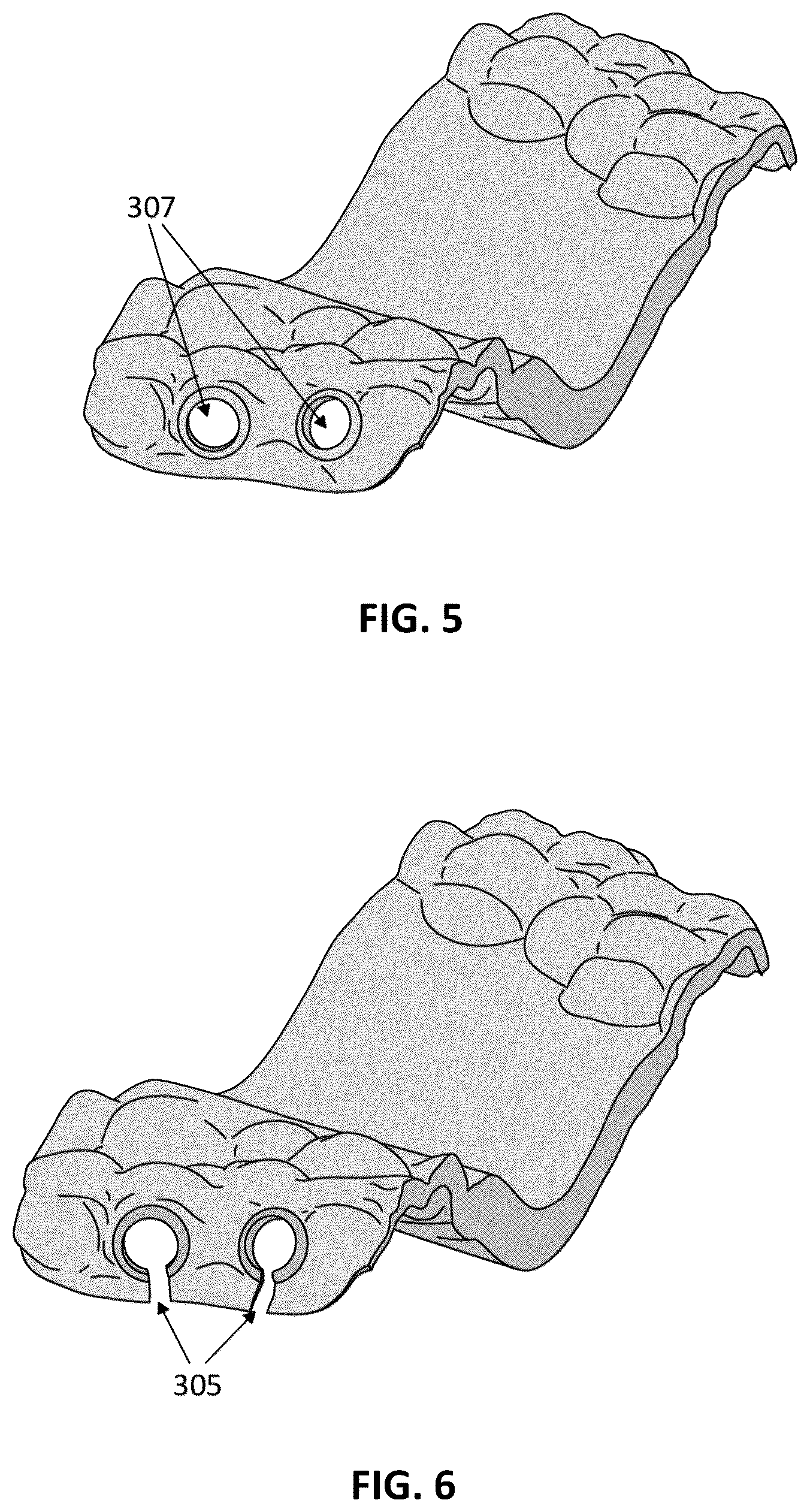 Patent US12097086 Figure 3 – Palatal expanders and methods of designing palatal expanders