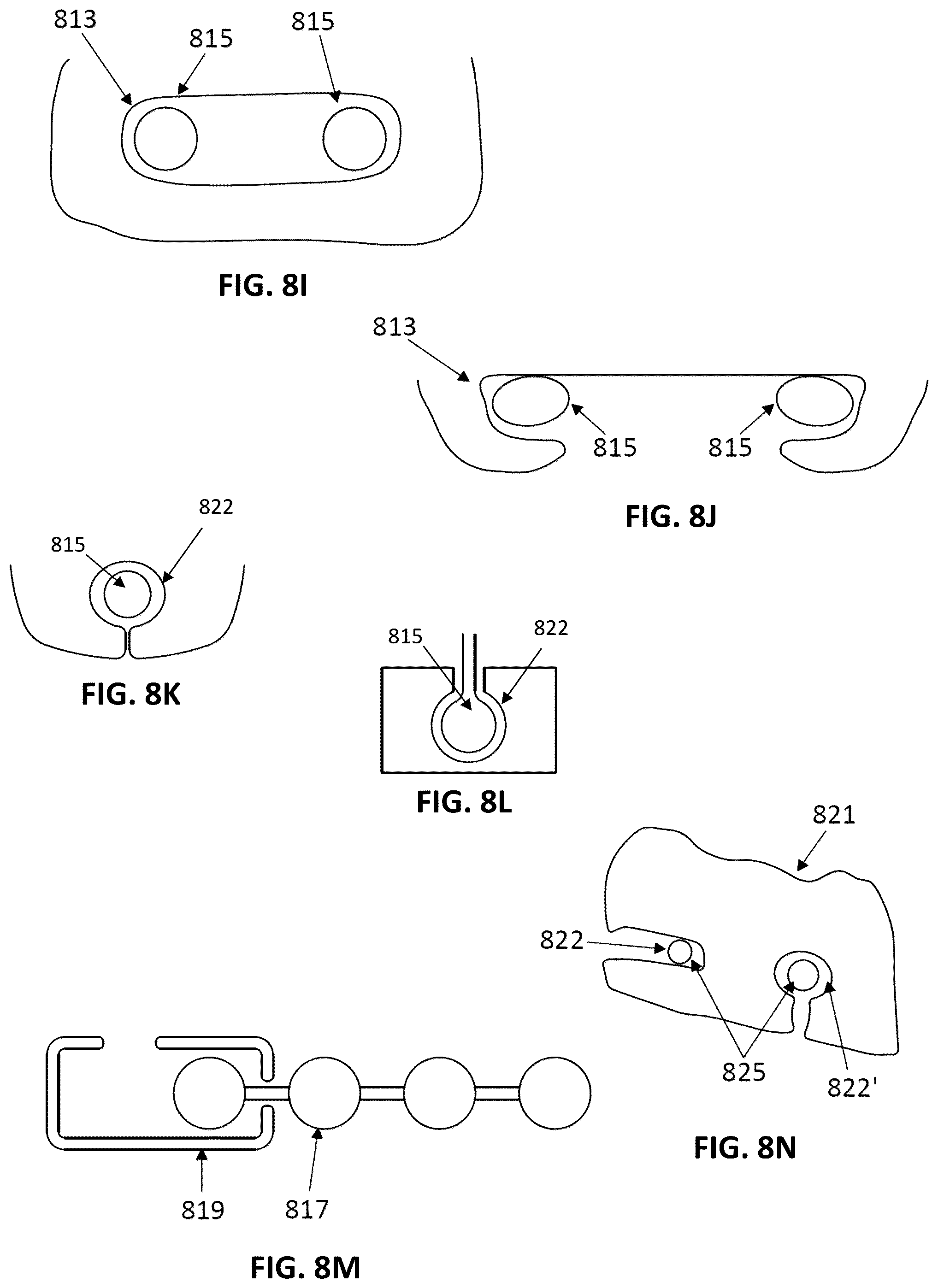 Patent US12097086 Figure 5 – Palatal expanders and methods of designing palatal expanders