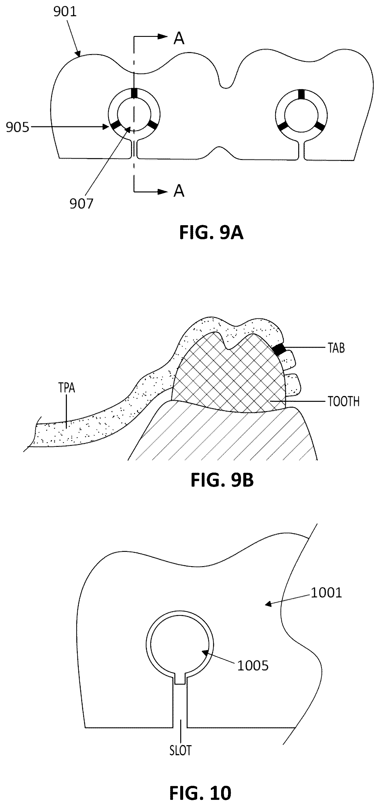 Patent US12097086 Figure 6 – Palatal expanders and methods of designing palatal expanders
