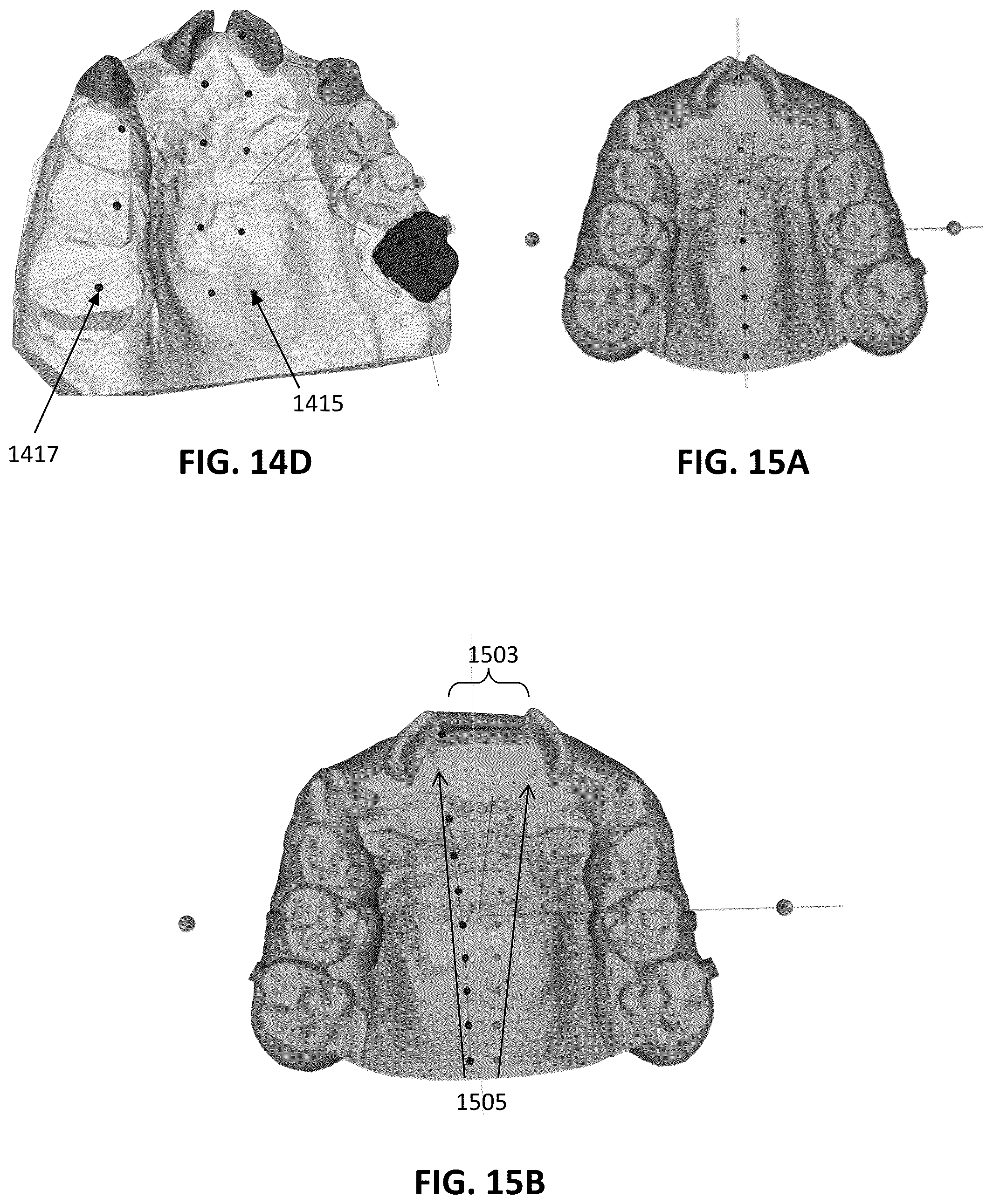 Patent US12097086 Figure 12 – Palatal expanders and methods of designing palatal expanders