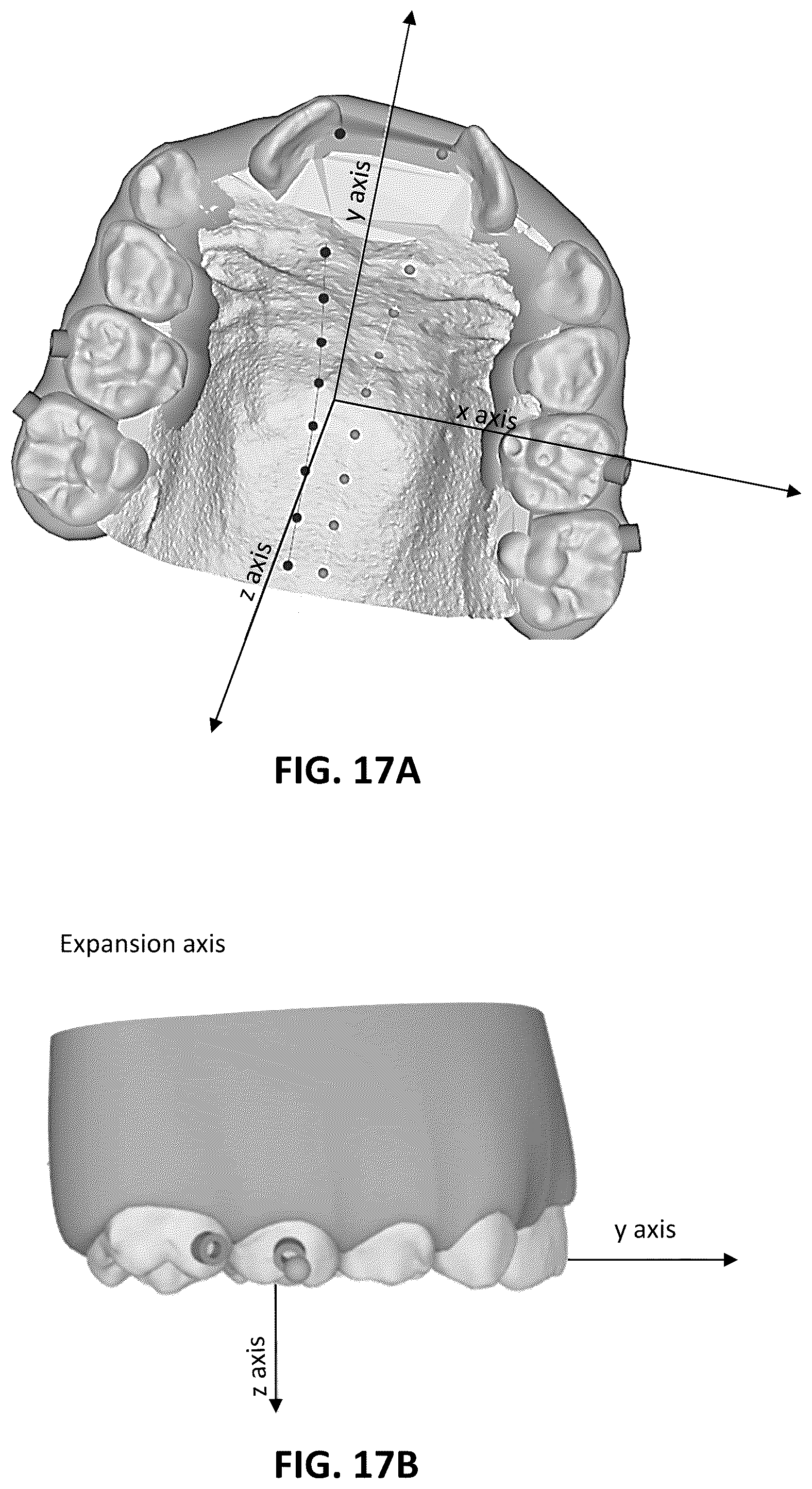 Patent US12097086 Figure 14 – Palatal expanders and methods of designing palatal expanders