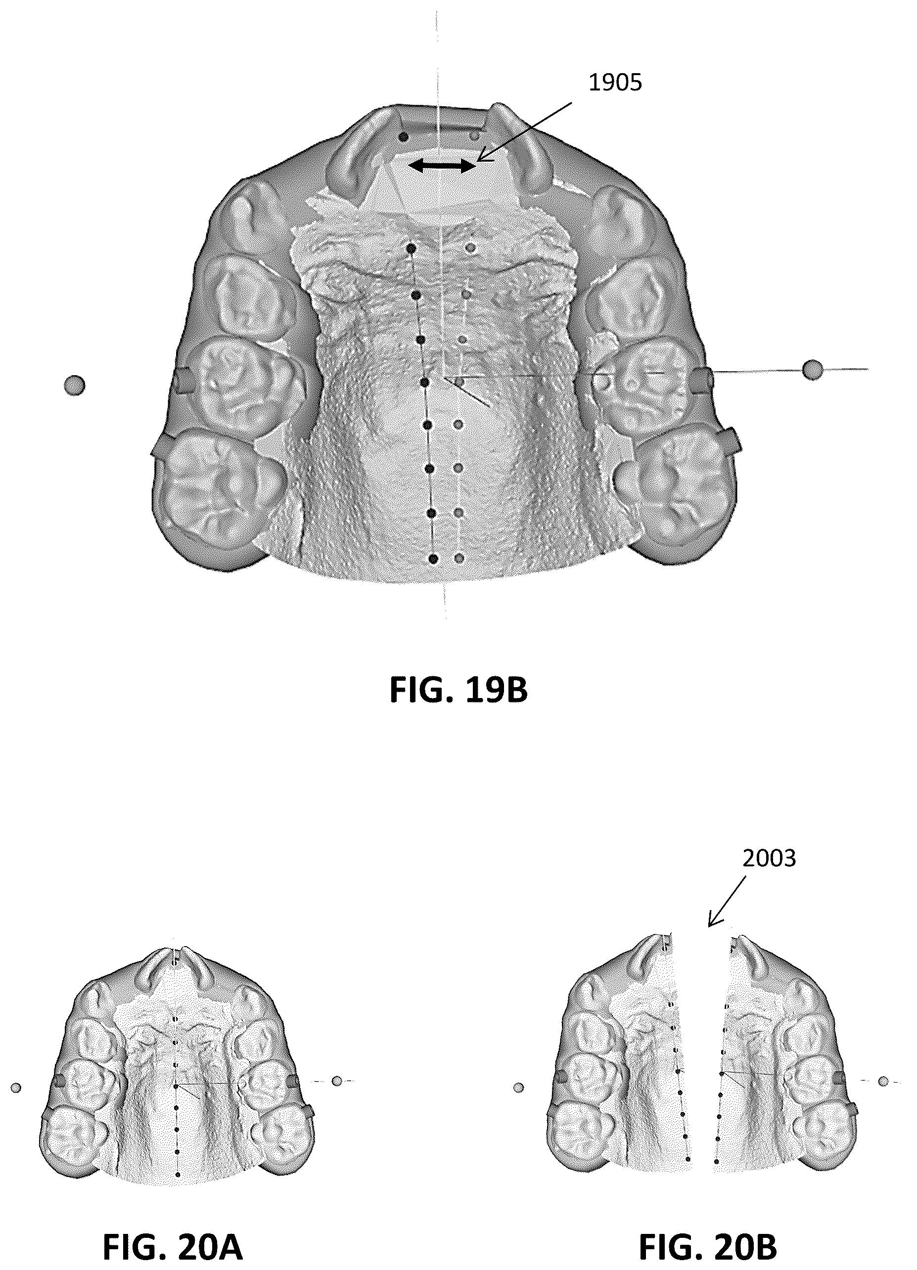 Patent US12097086 Figure 16 – Palatal expanders and methods of designing palatal expanders