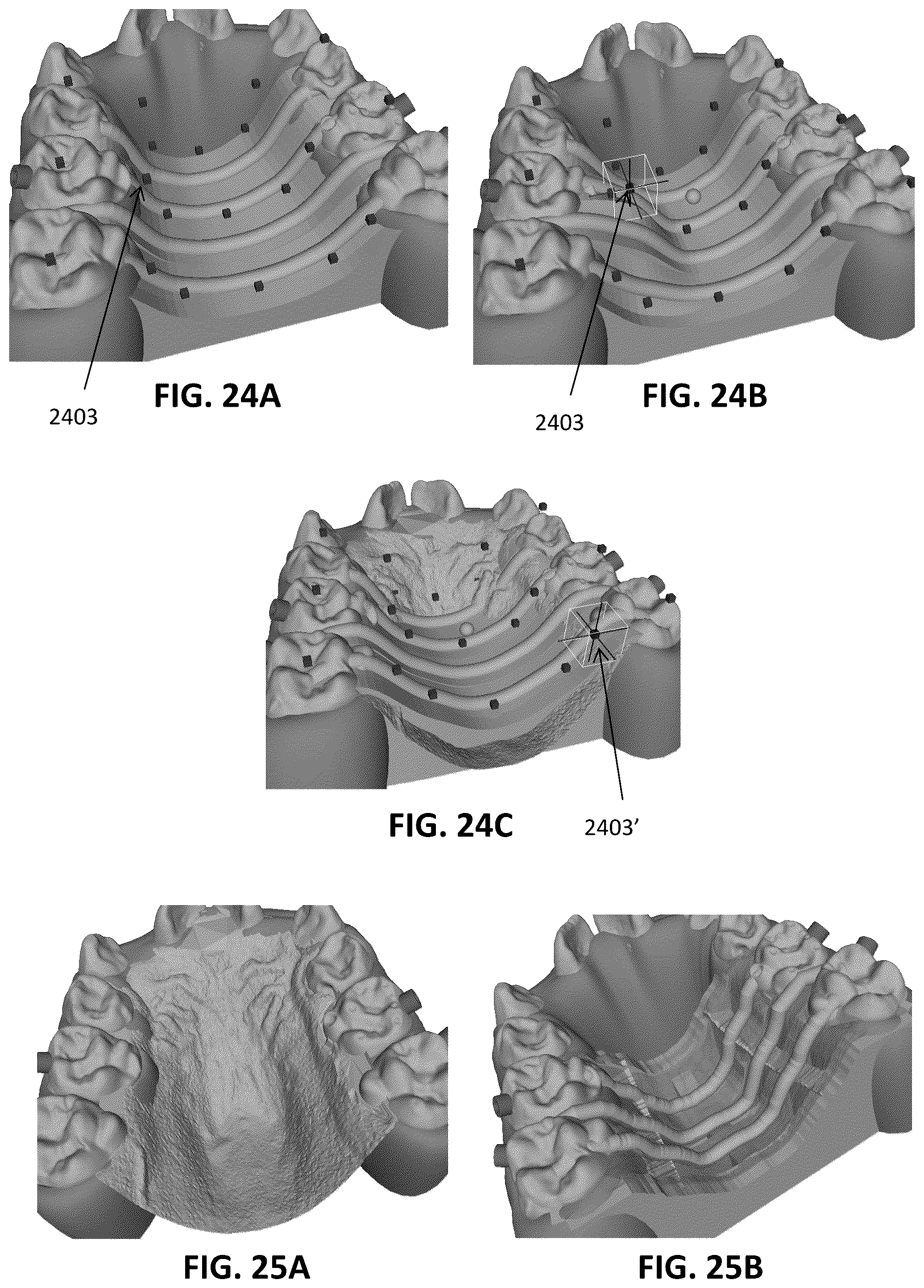 Patent US12097086 Figure 19 – Palatal expanders and methods of designing palatal expanders