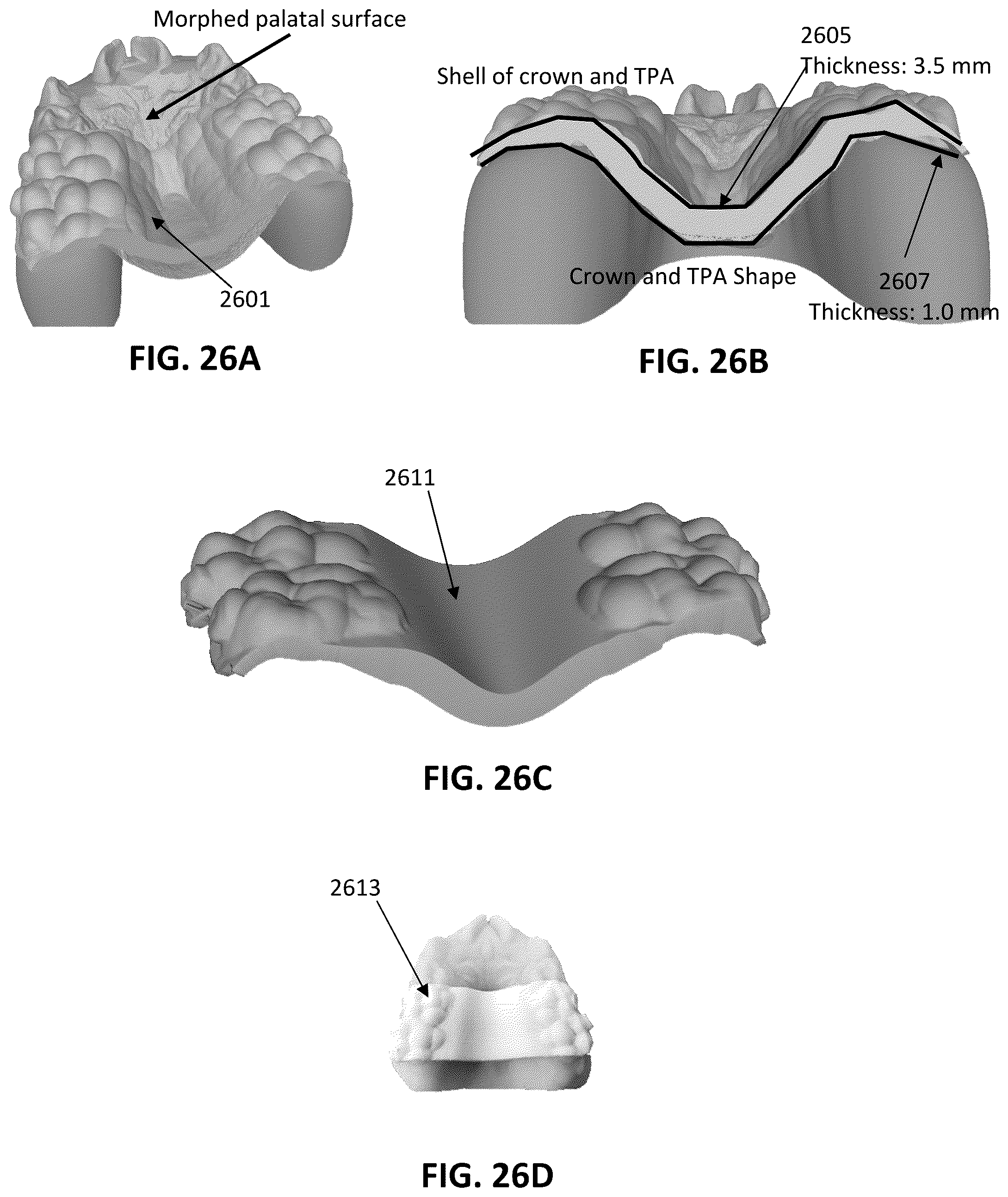 Patent US12097086 Figure 20 – Palatal expanders and methods of designing palatal expanders