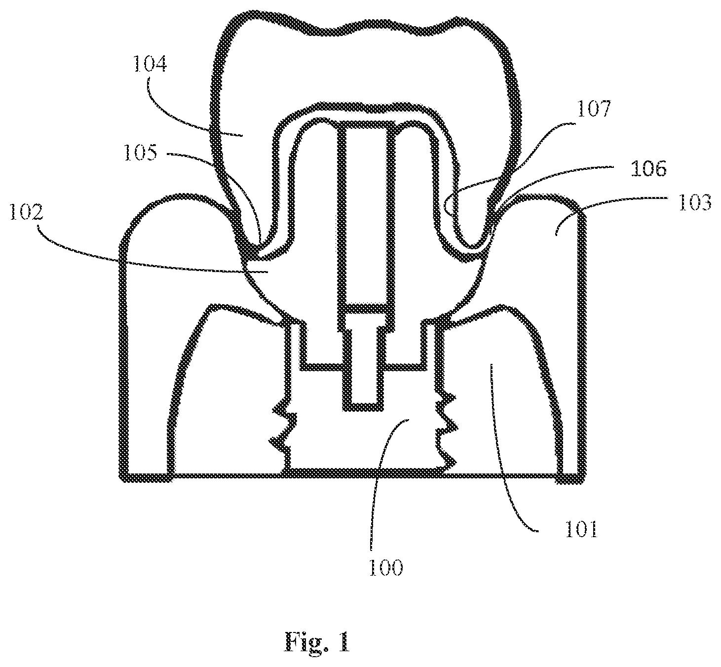 Patent US12097087 Figure 1 – Ceramic bodies having antimicrobial properties and methods of making the same