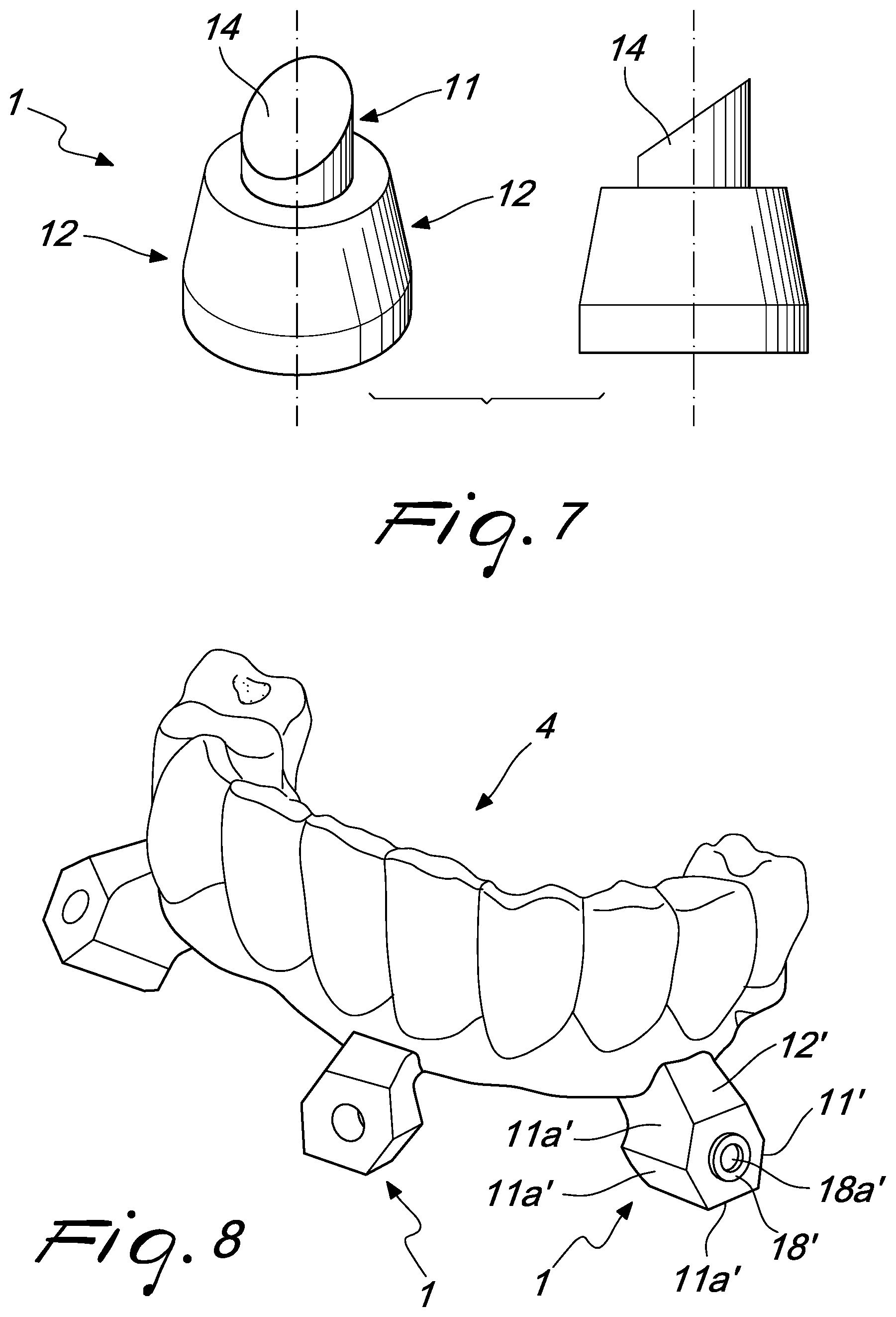 Patent US12097088 Figure 4 – Fixing pin support for dental prostheses and method of the manufacturing thereof