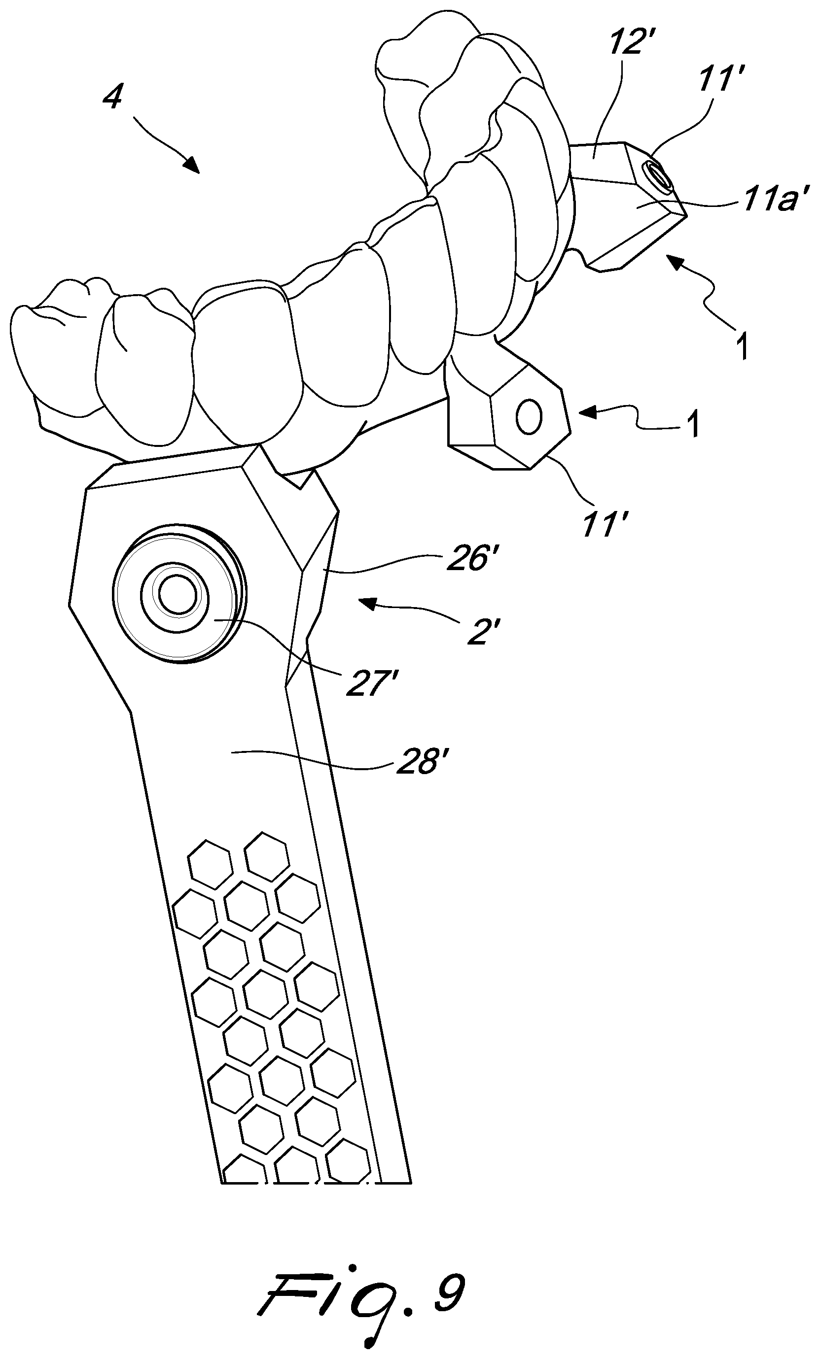 Patent US12097088 Figure 5 – Fixing pin support for dental prostheses and method of the manufacturing thereof