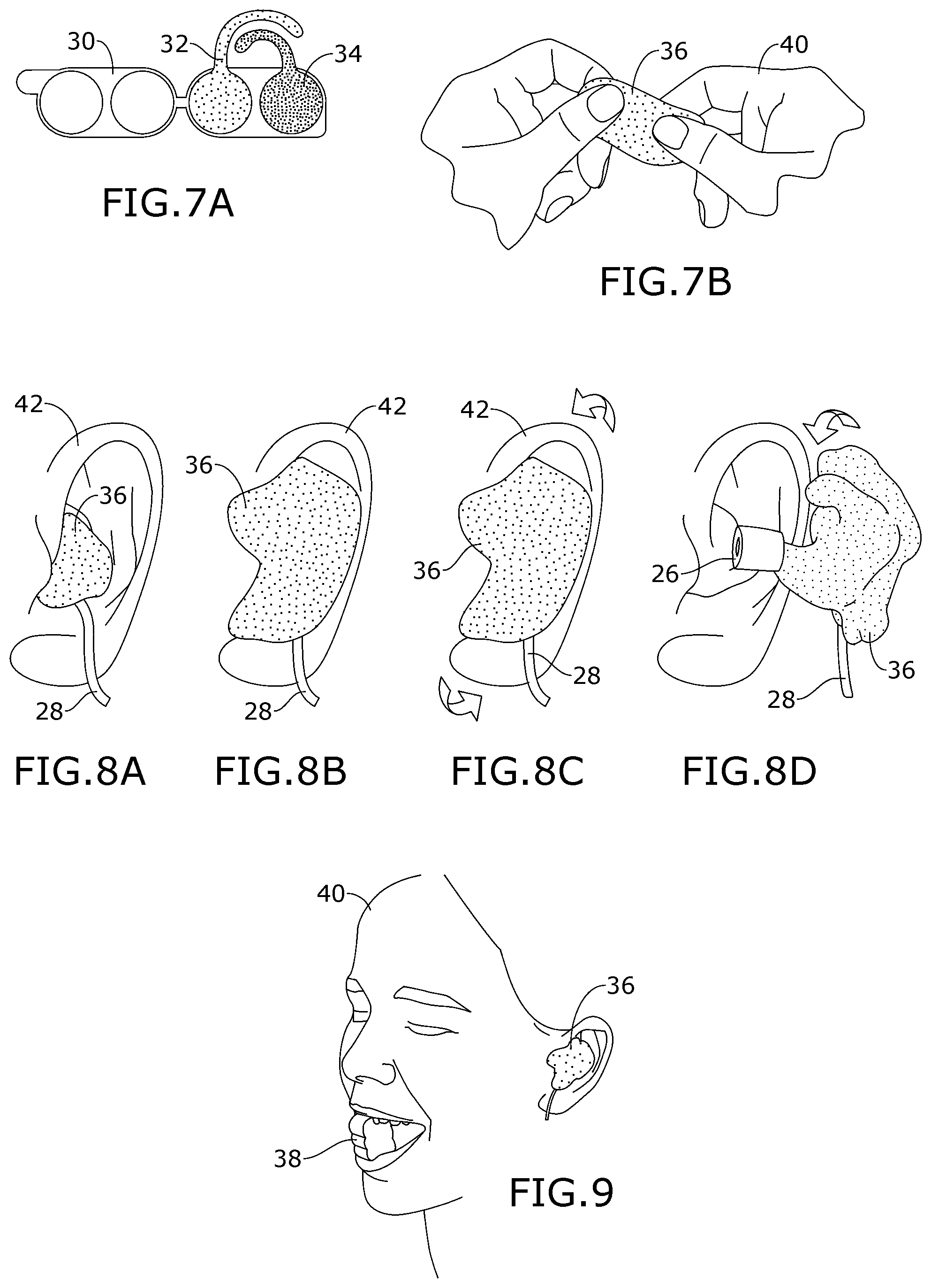 Patent US12097091 Figure 4 – Oto-block applicator and method