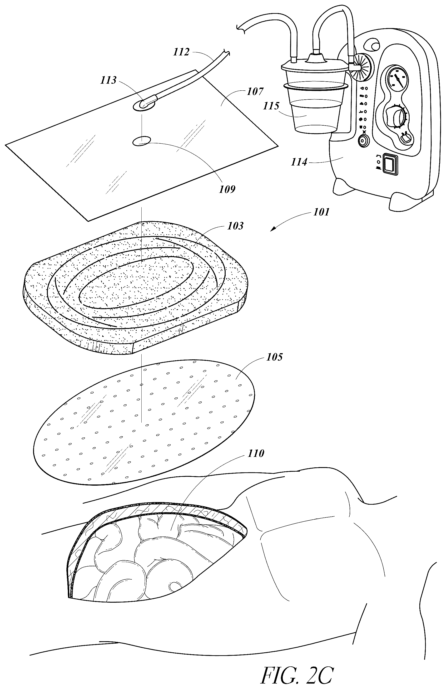 Patent US12097092 Figure 5 – pH sensing for sensor enabled negative pressure wound monitoring and therapy apparatuses