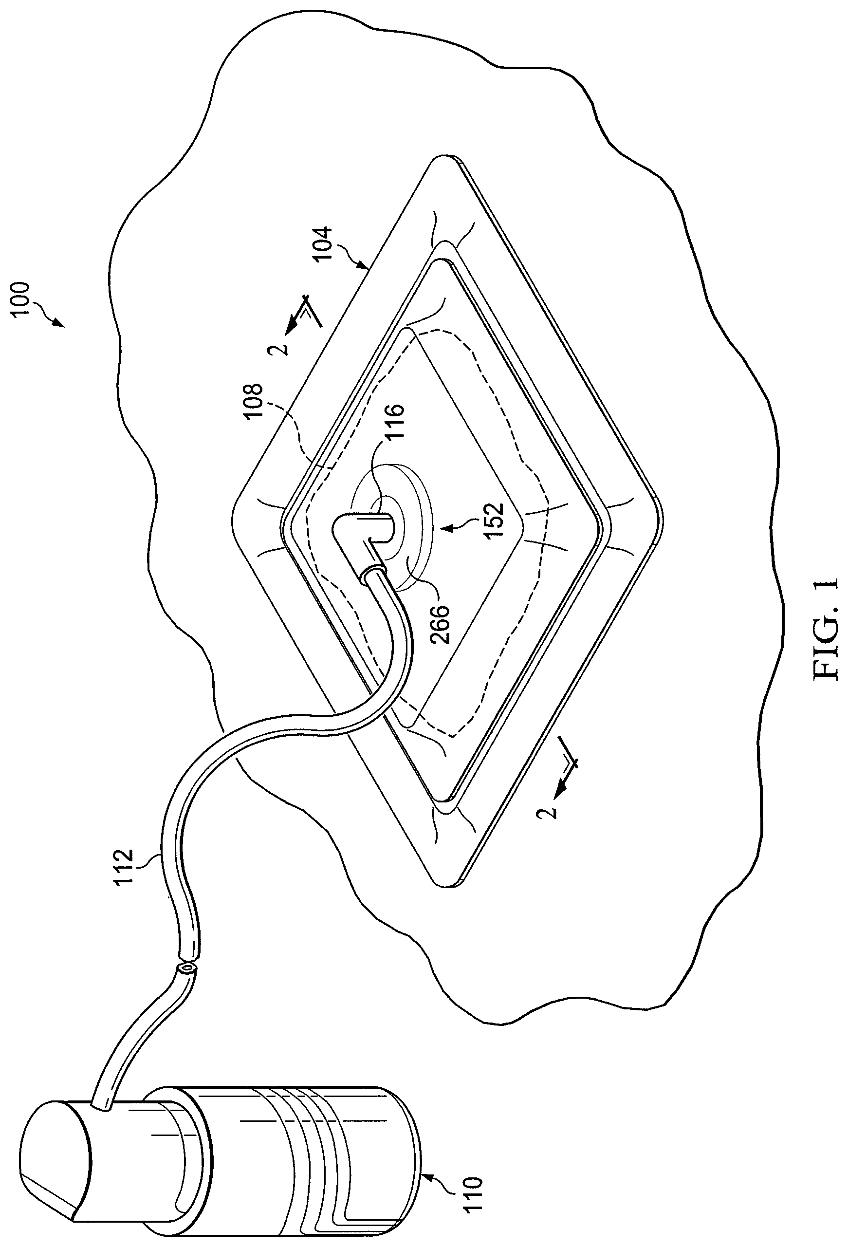 Patent US12097094 Figure 1 – Dressing and method for applying reduced pressure to and collecting and storing fluid from a tissue site