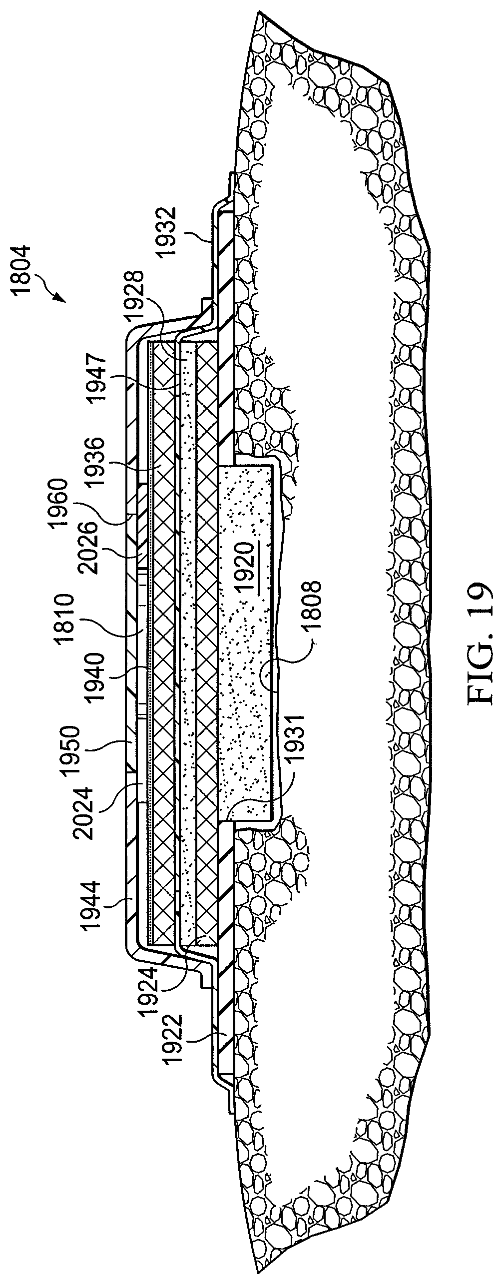 Patent US12097094 Figure 15 – Dressing and method for applying reduced pressure to and collecting and storing fluid from a tissue site