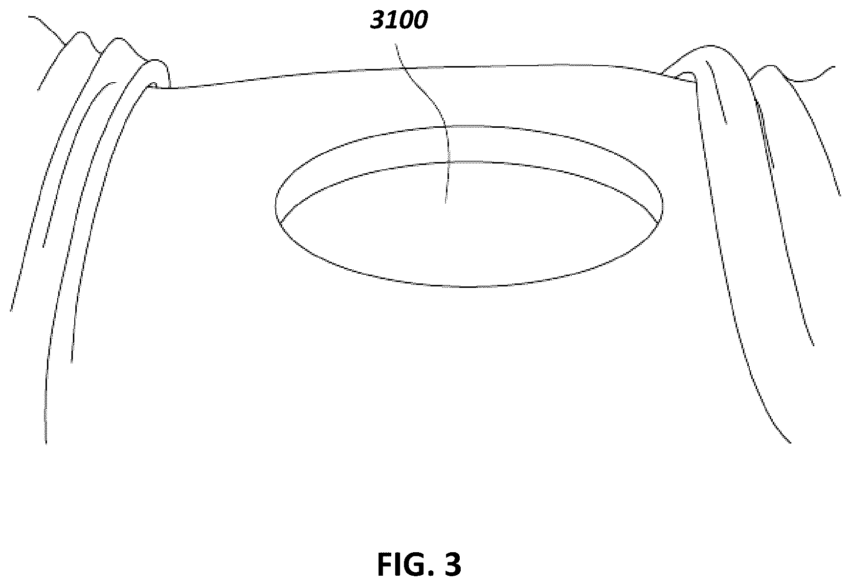Patent US12097096 Figure 3 – Customizable wound closure device and method of use