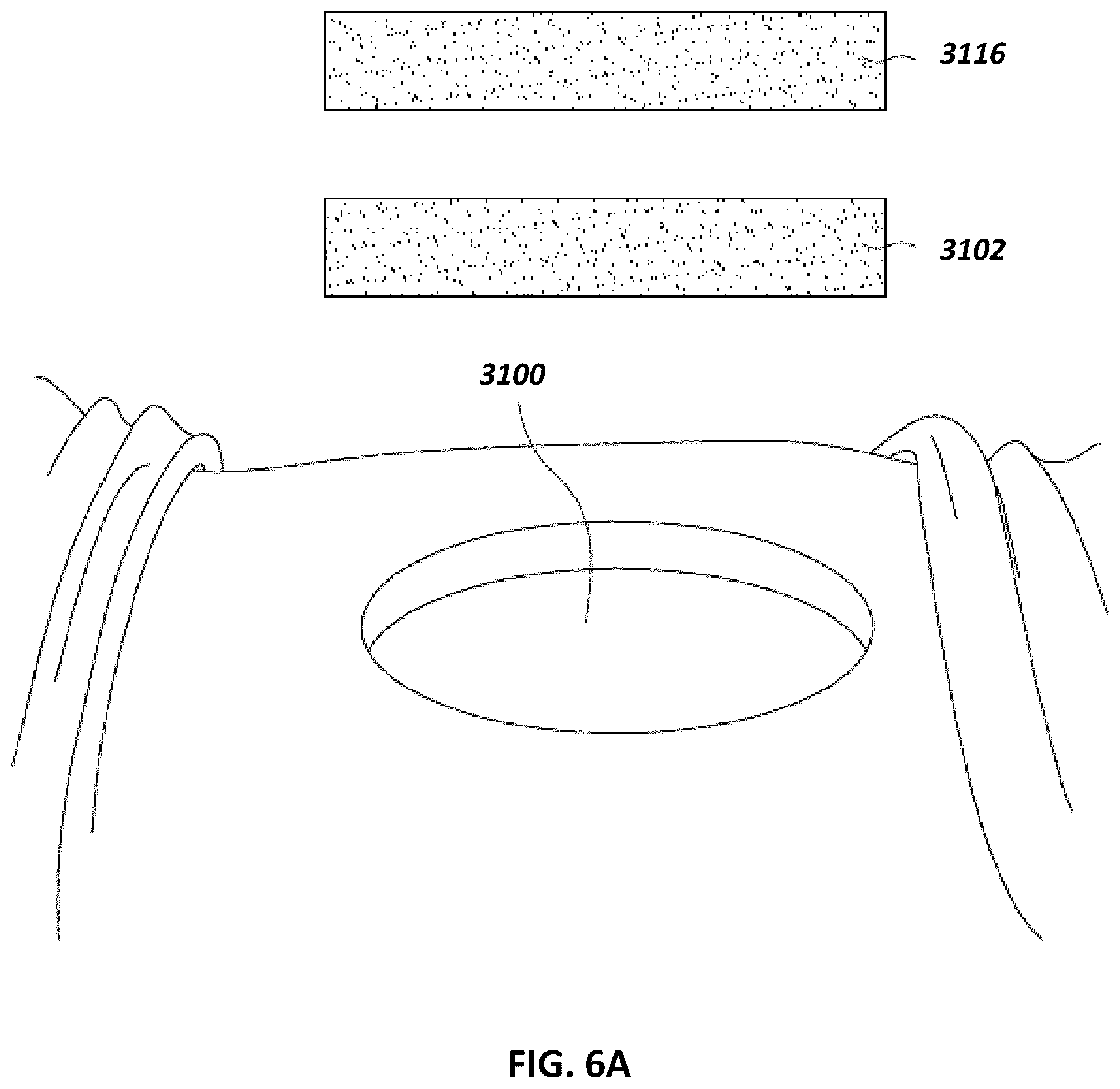 Patent US12097096 Figure 6 – Customizable wound closure device and method of use
