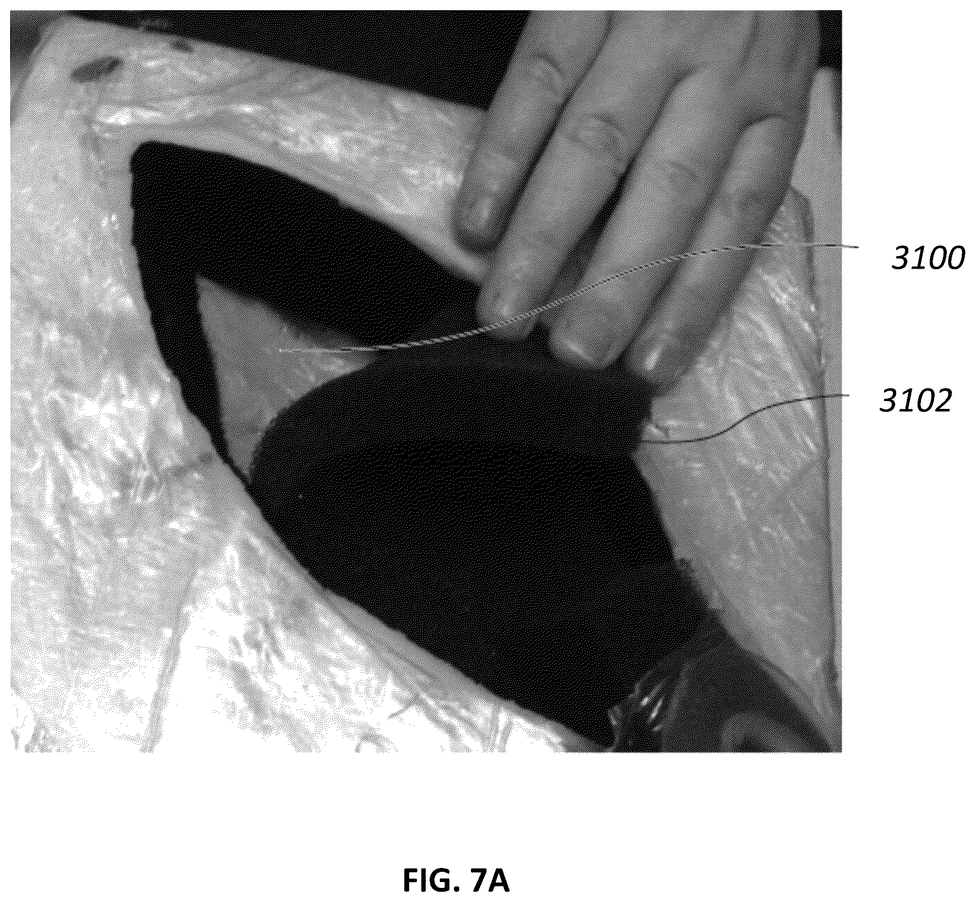 Patent US12097096 Figure 8 – Customizable wound closure device and method of use